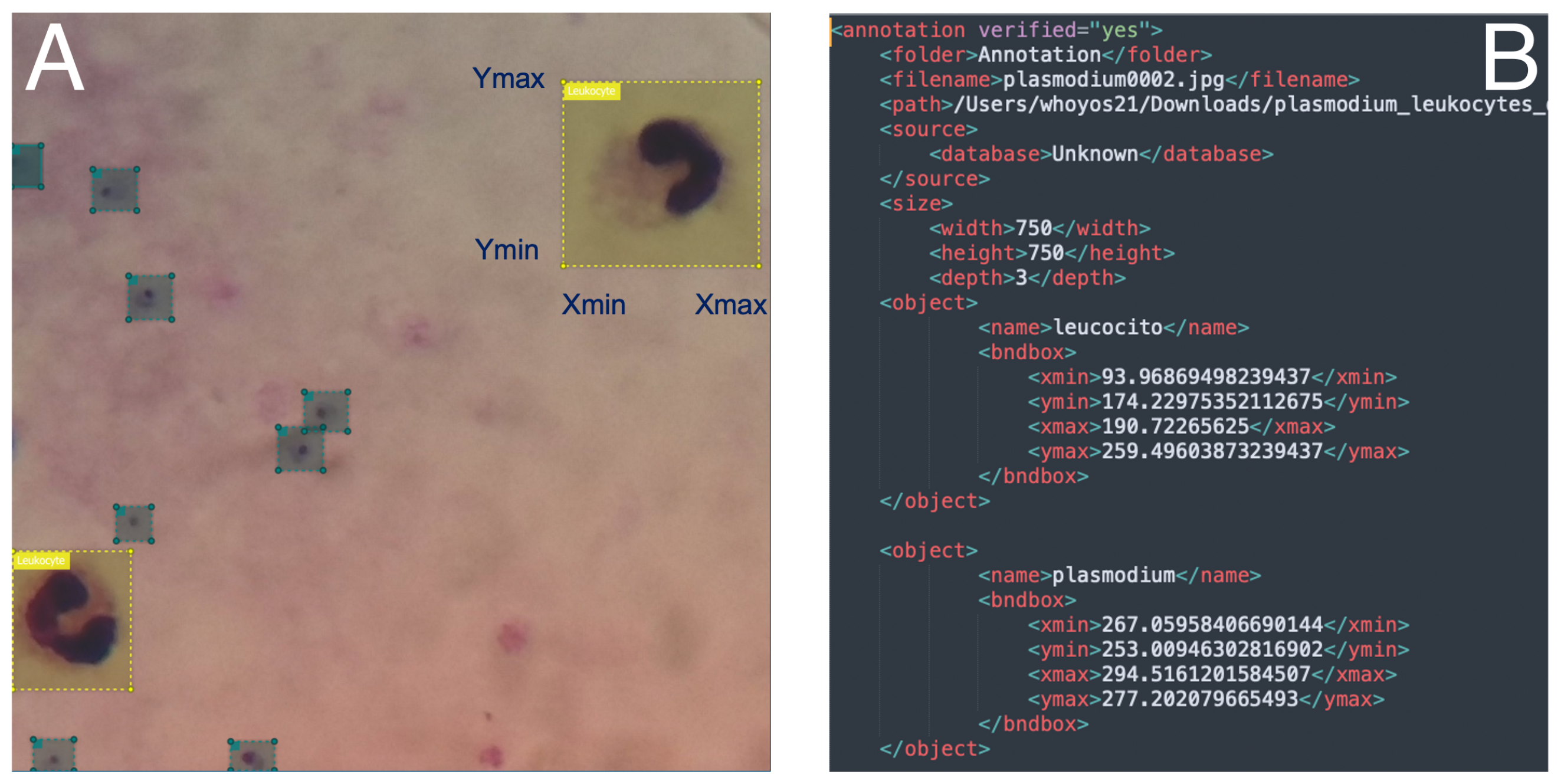 Diagnostics 14 00690 g003