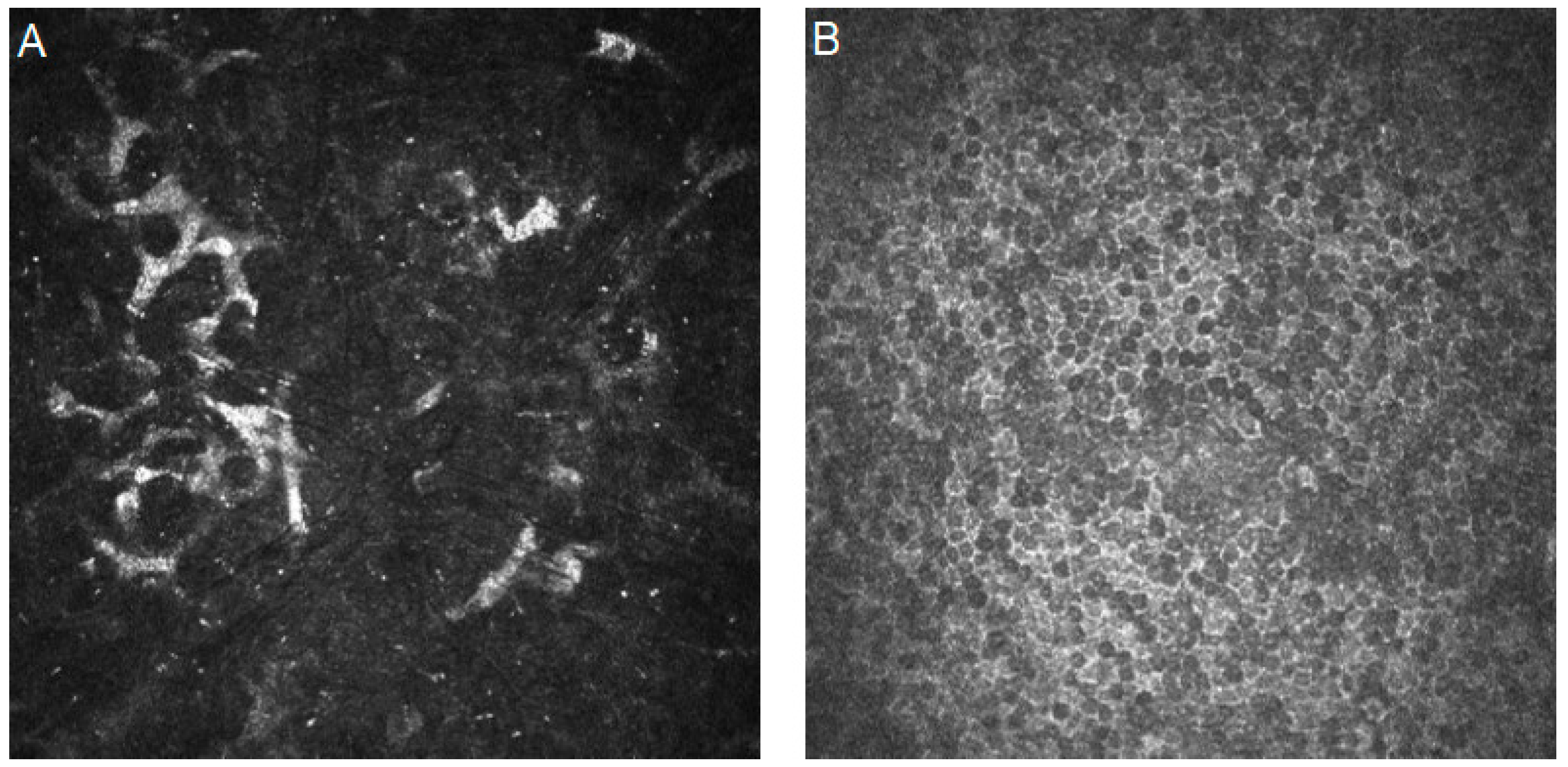 Diagnostics 14 00694 g006