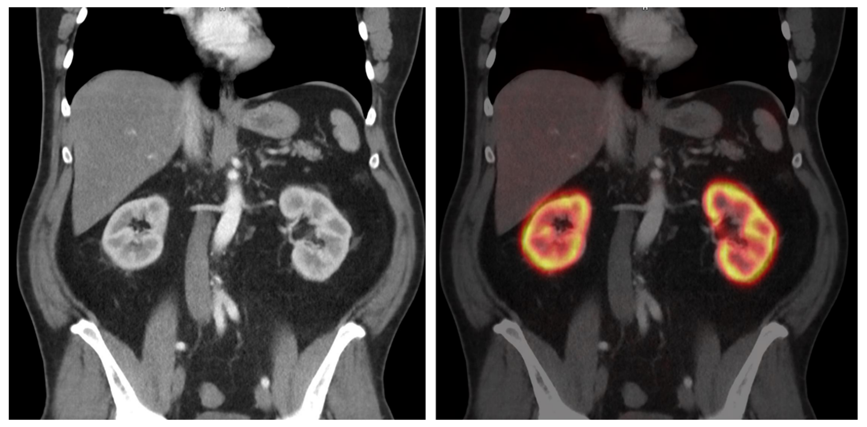 Diagnostics 14 00696 g001