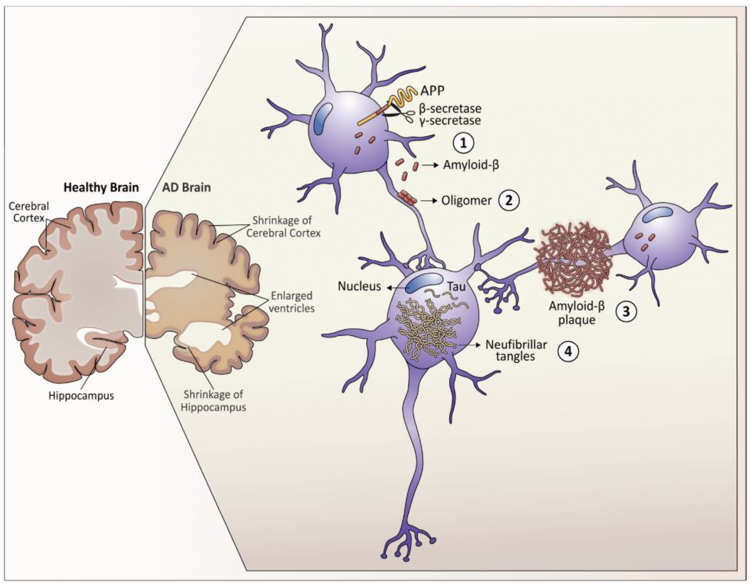 Neuropathology, Neuroimaging, and Fluid Biomarkers in