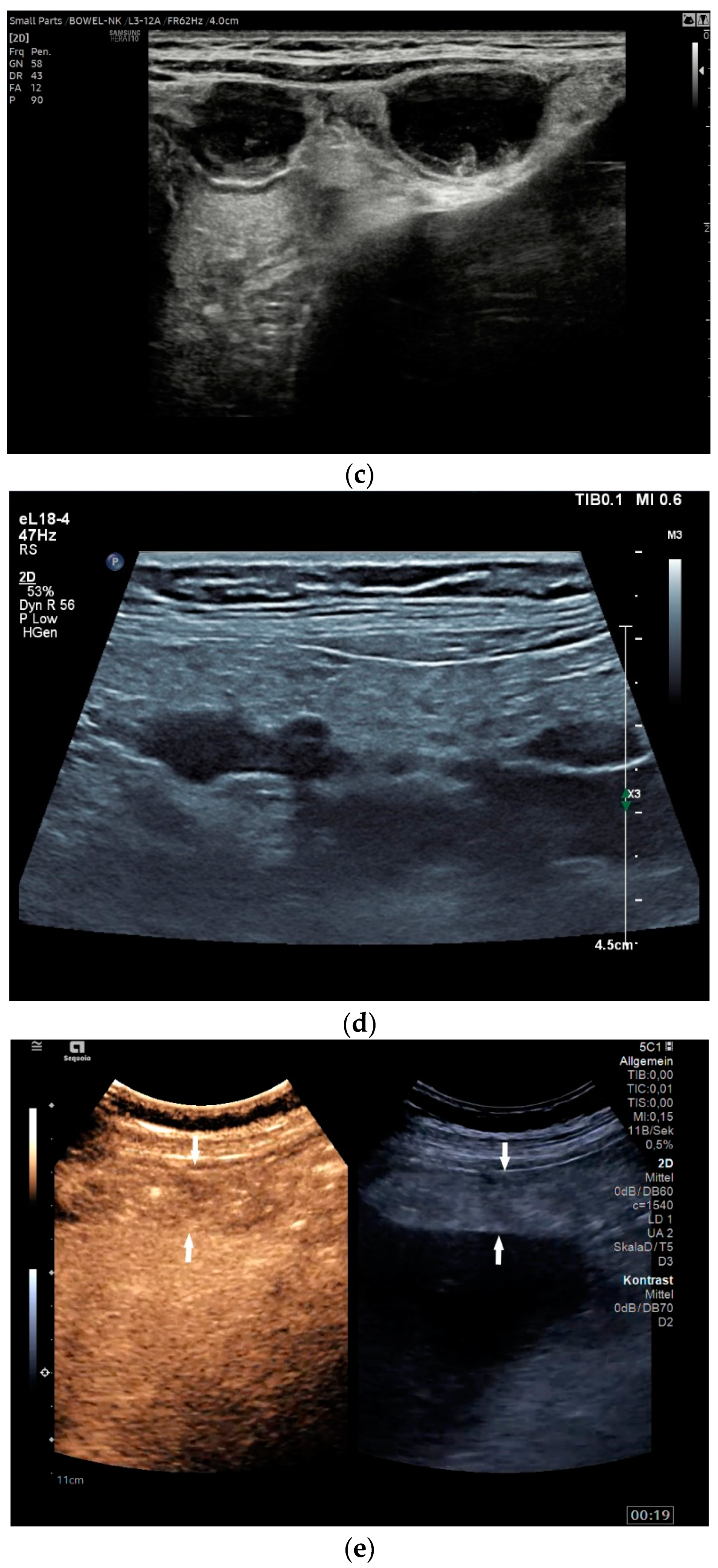 Diagnostics 14 00706 g001b