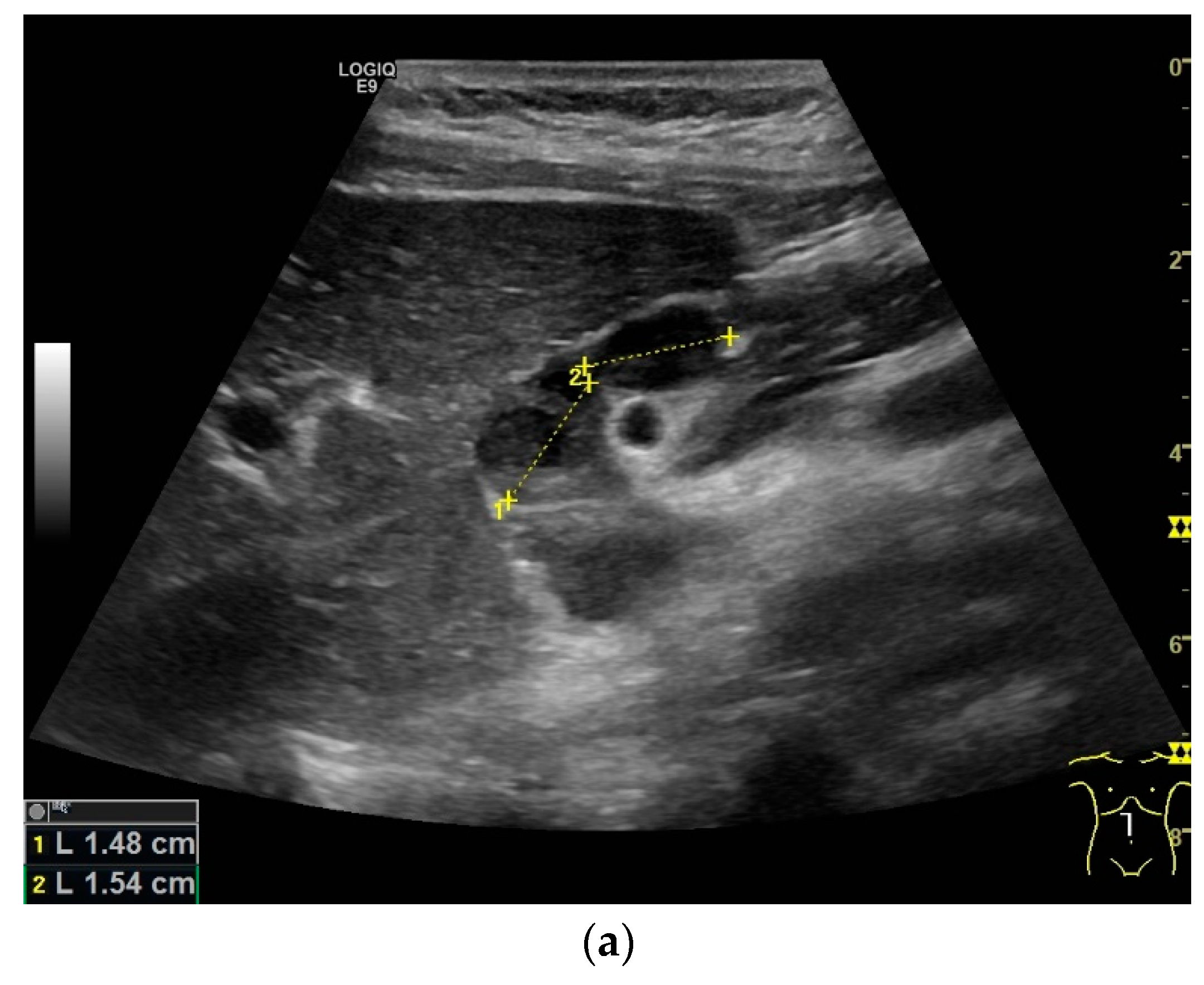 Diagnostics 14 00706 g002a