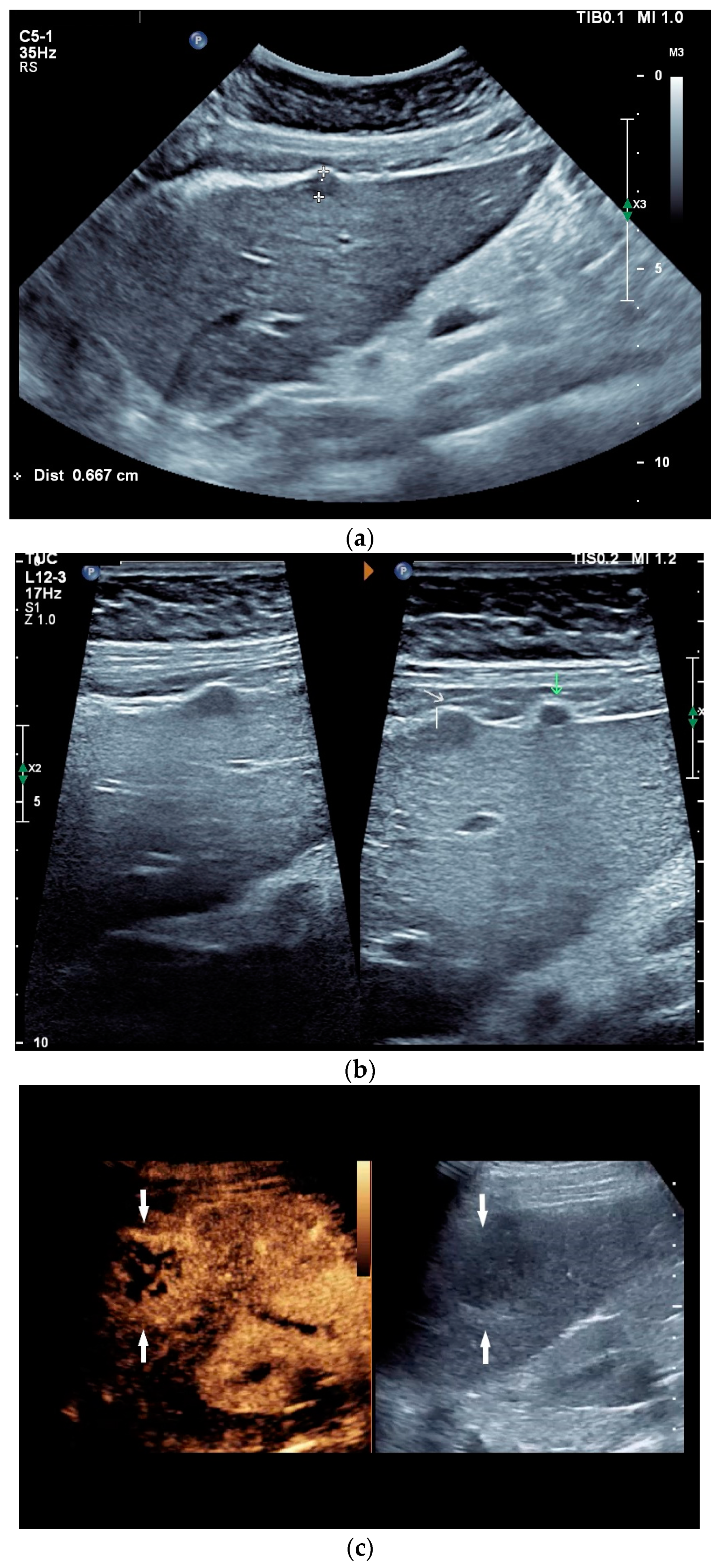 Diagnostics 14 00706 g003a