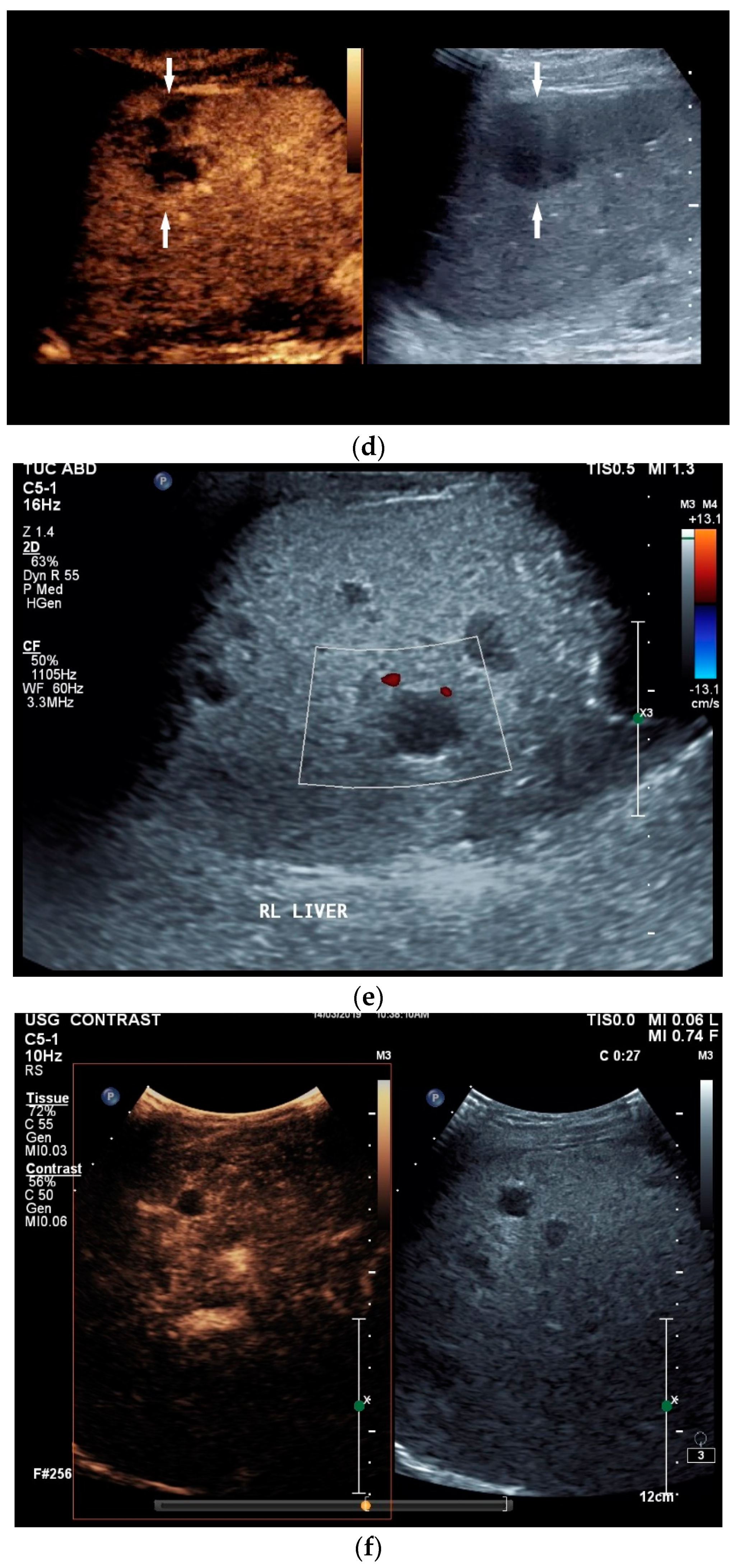 Diagnostics 14 00706 g003b