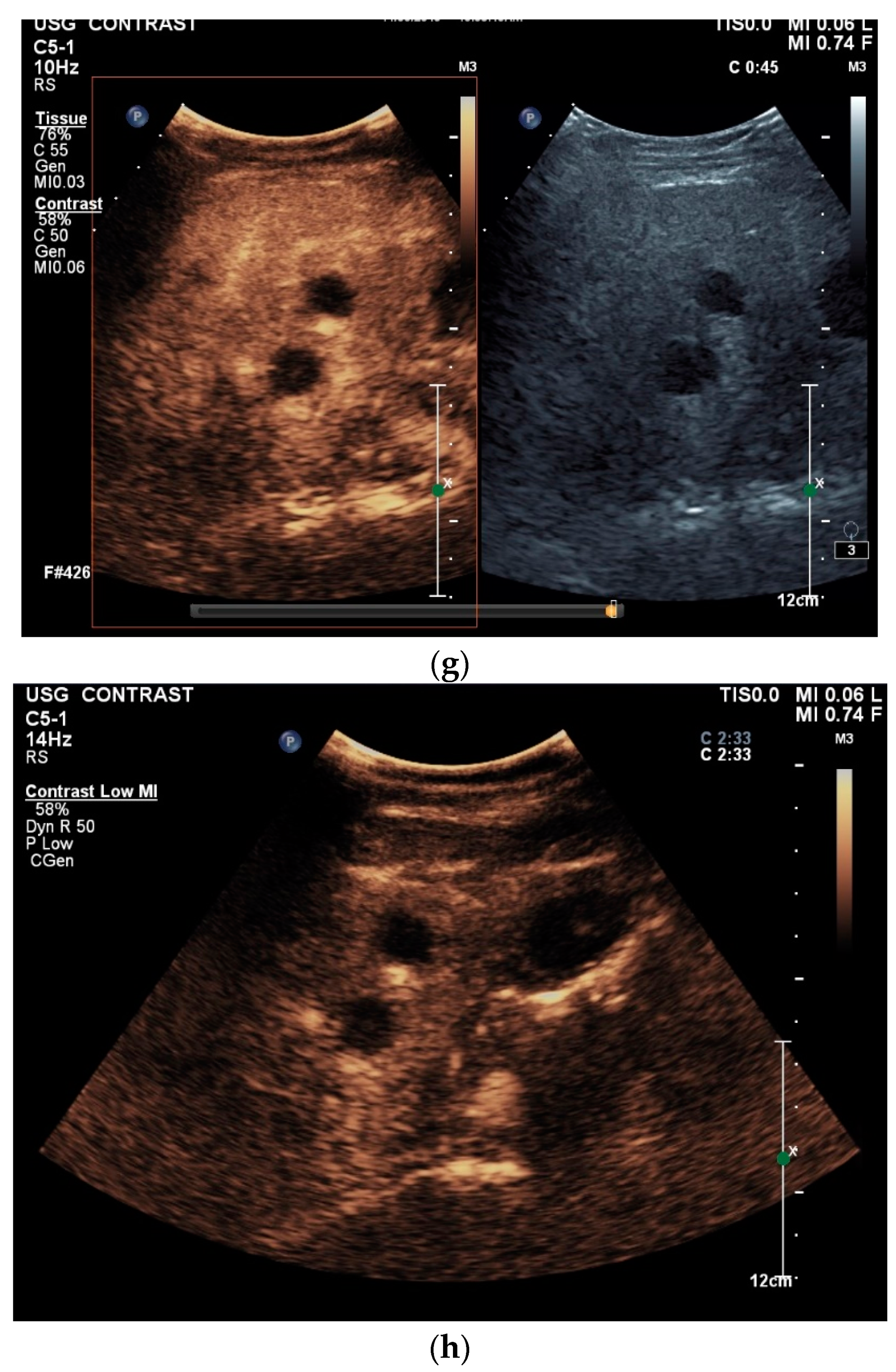 Diagnostics 14 00706 g003c