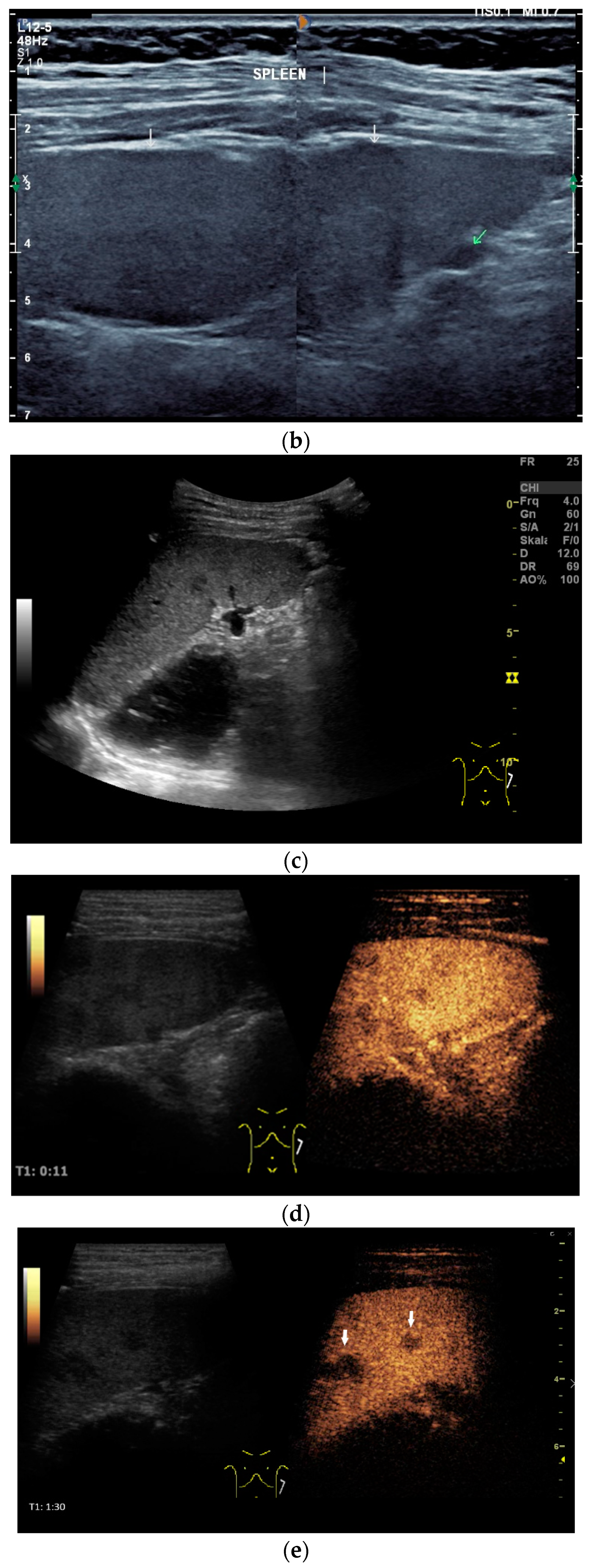 Diagnostics 14 00706 g004b