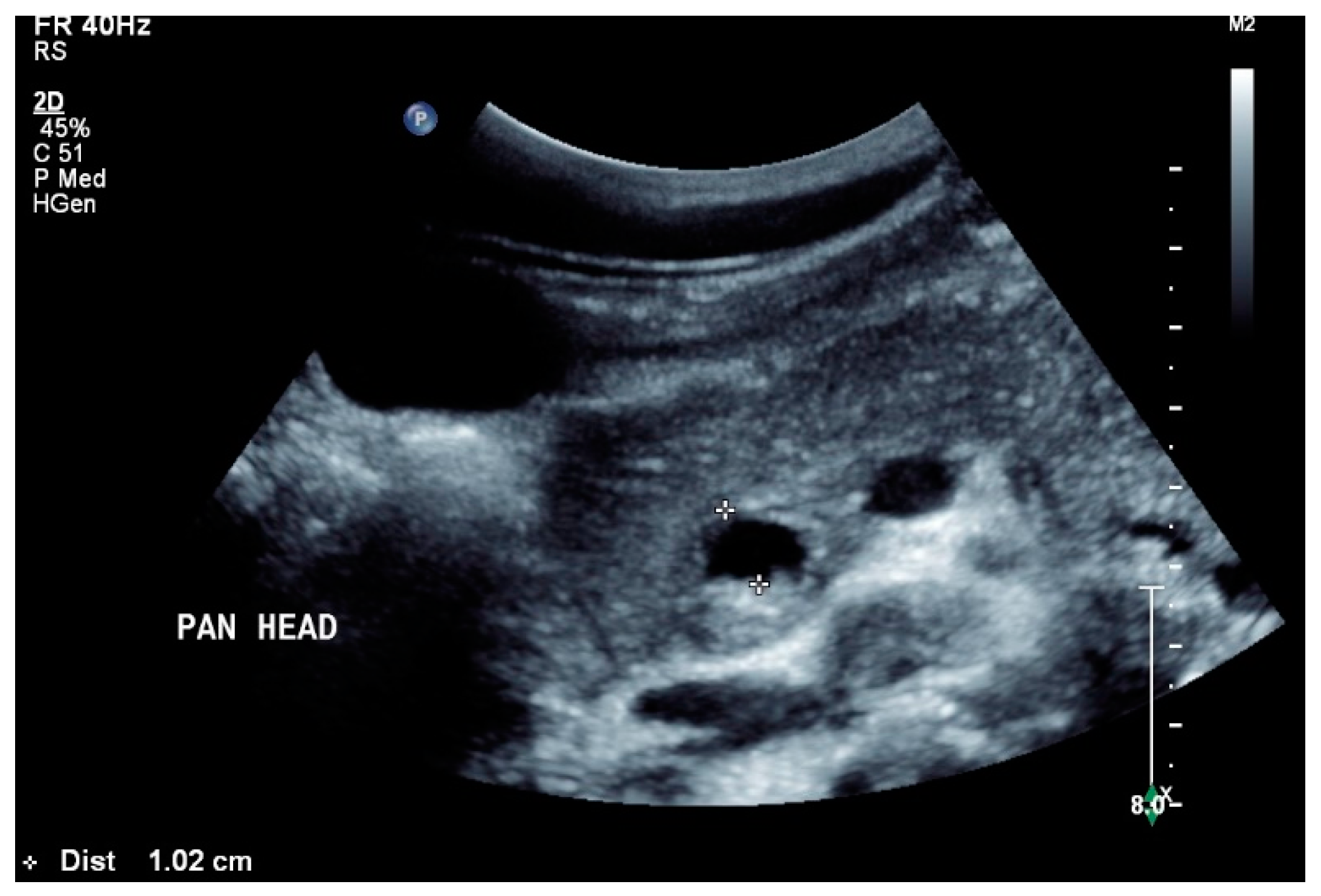 Diagnostics 14 00706 g005