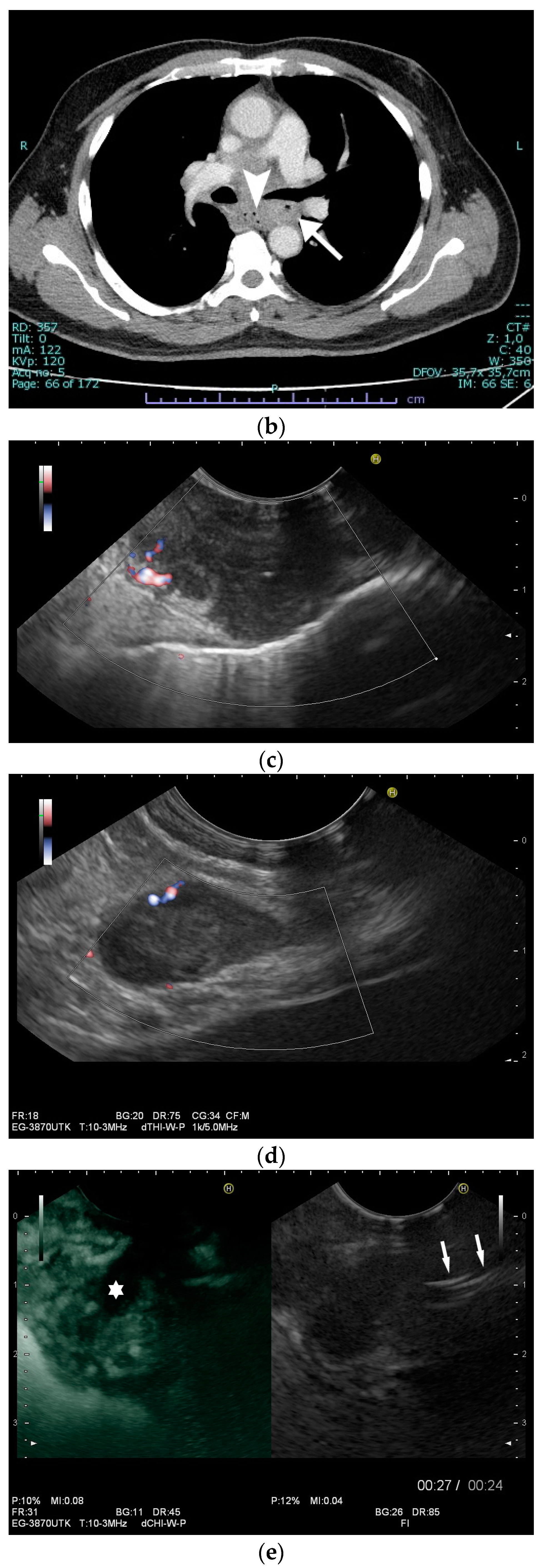 Diagnostics 14 00706 g006b