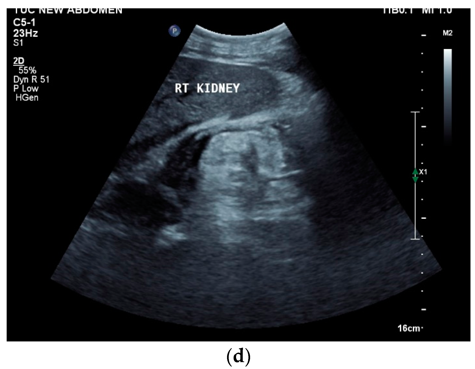 Diagnostics 14 00706 g007b