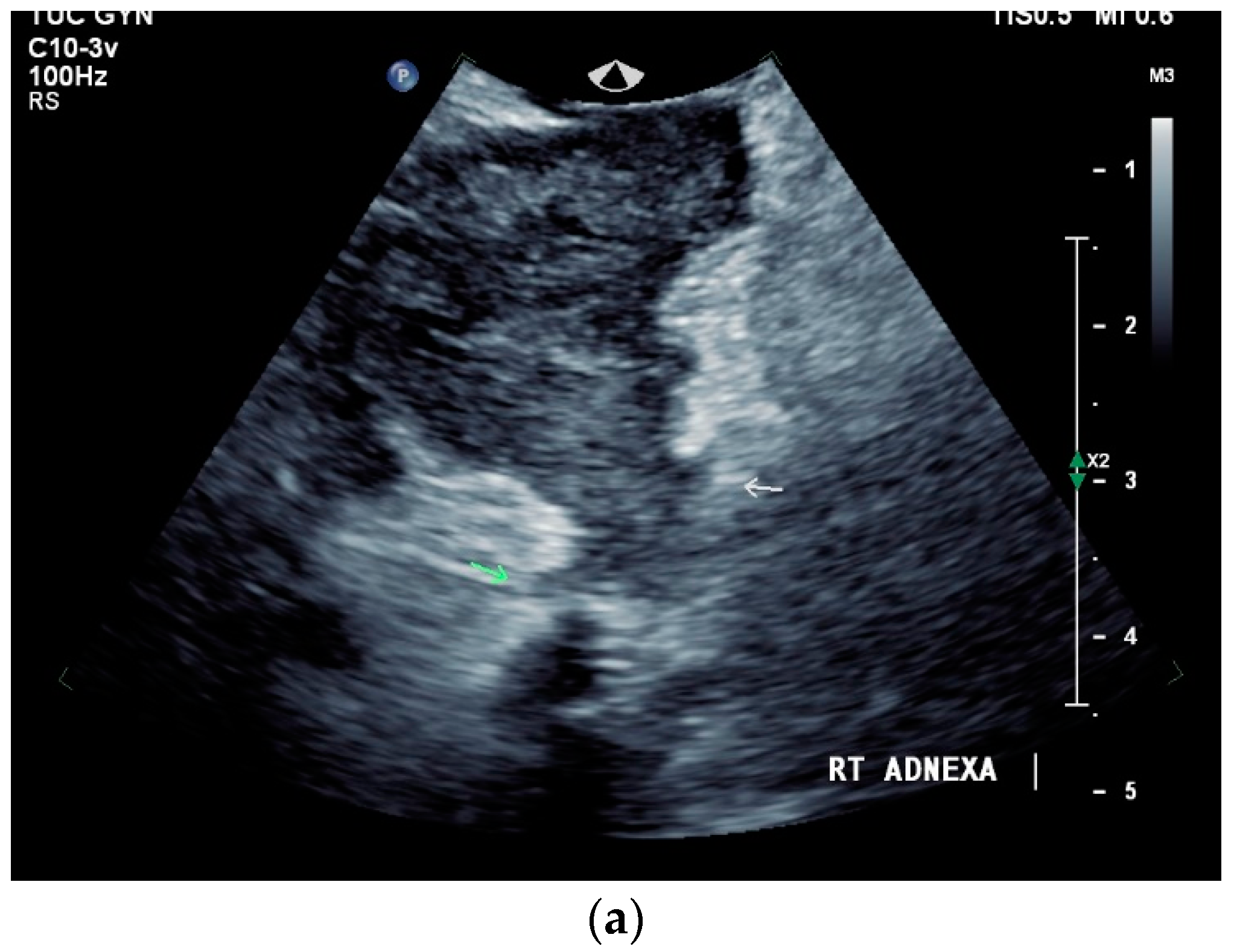 Diagnostics 14 00706 g008a