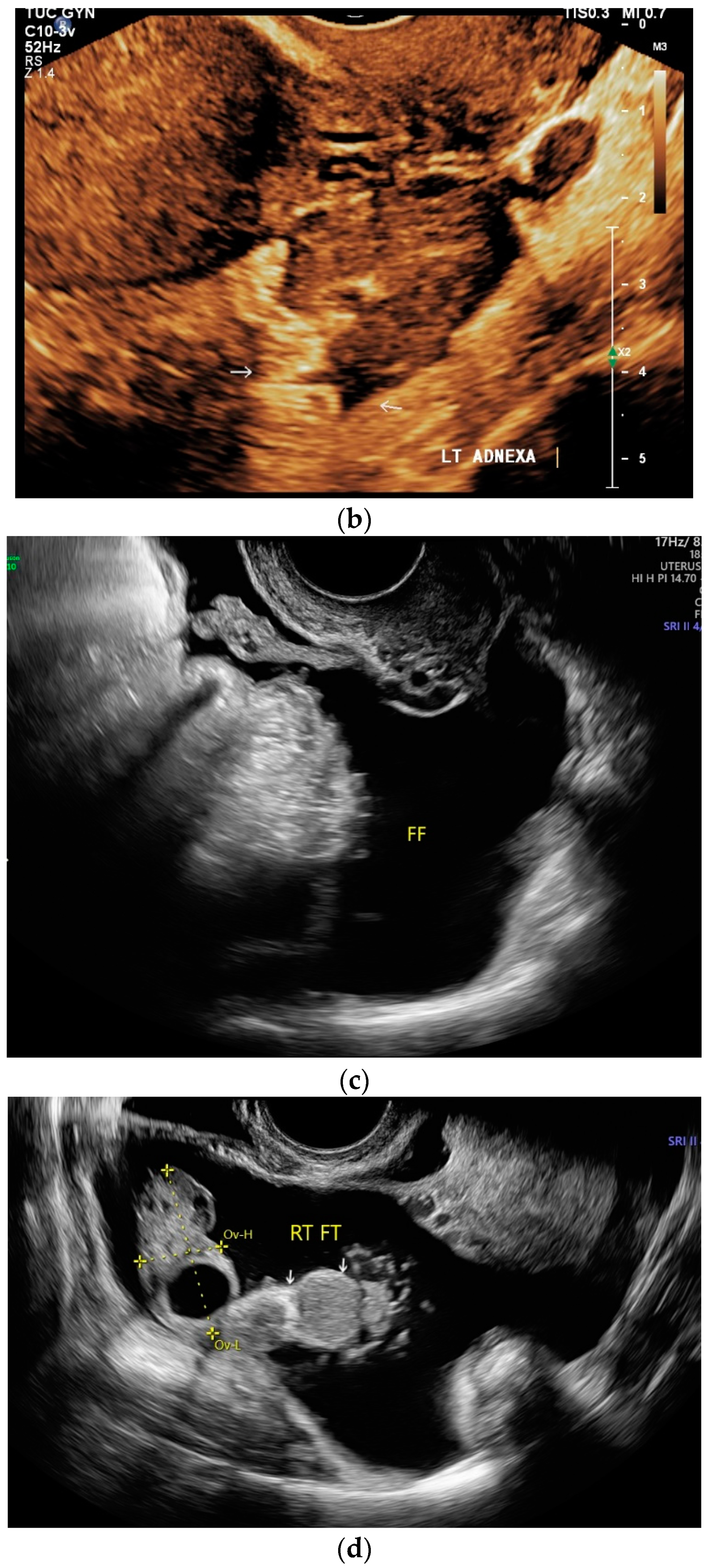 Diagnostics 14 00706 g008b