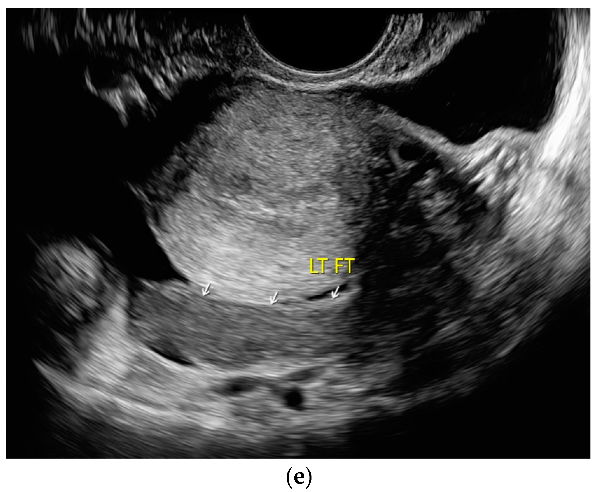 Diagnostics 14 00706 g008c