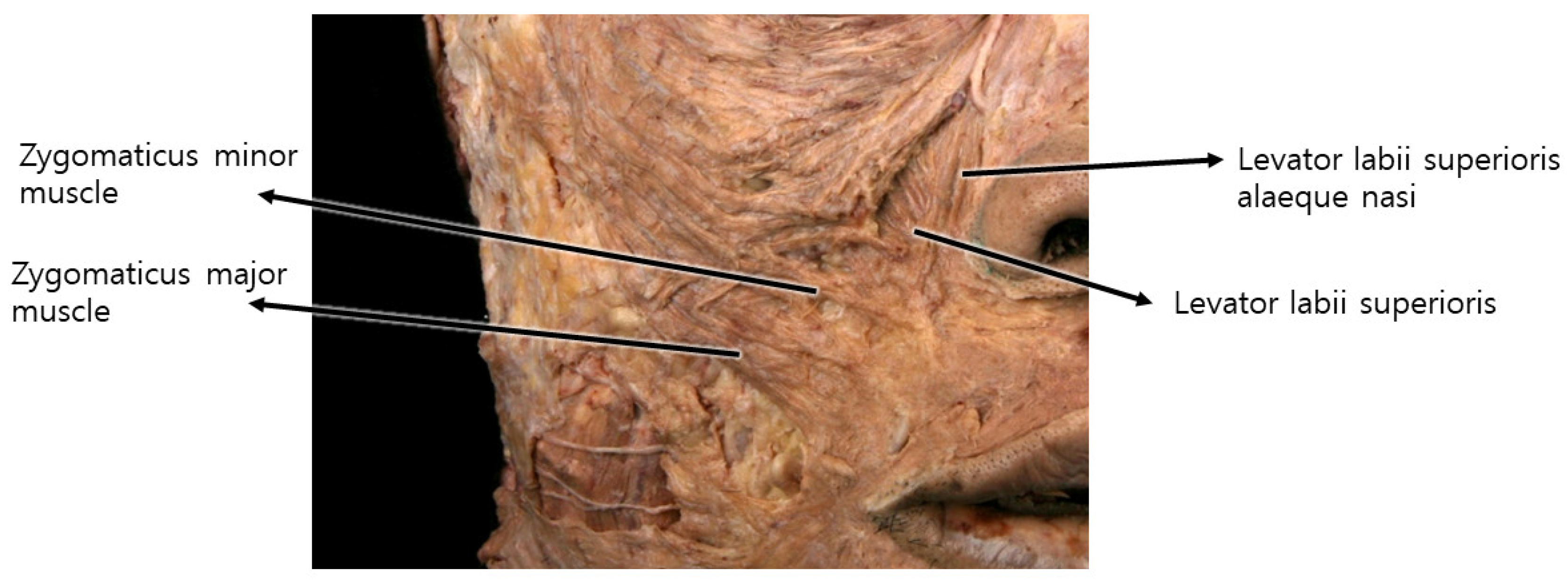 Diagnostics 14 00716 g004