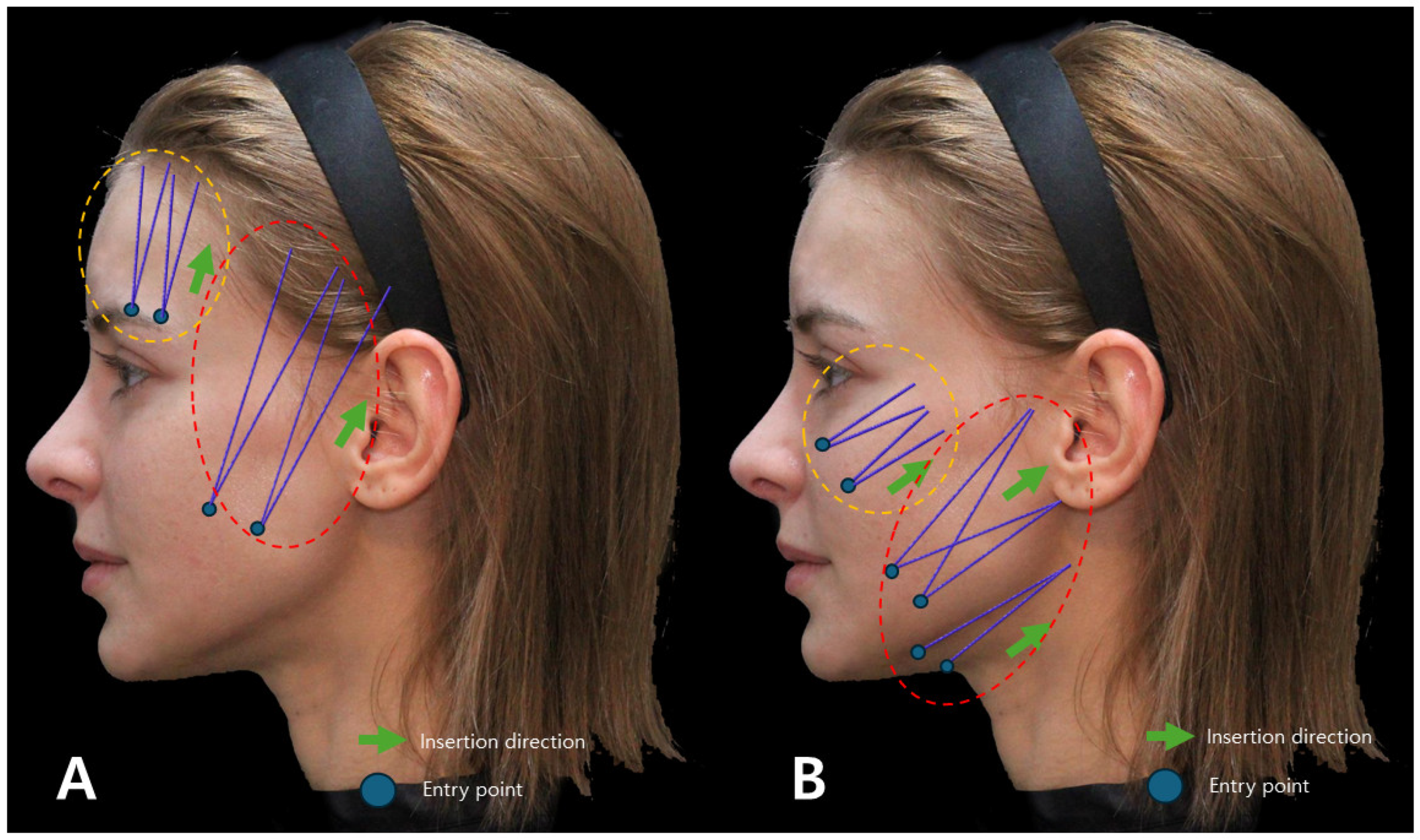 Diagnostics 14 00716 g009
