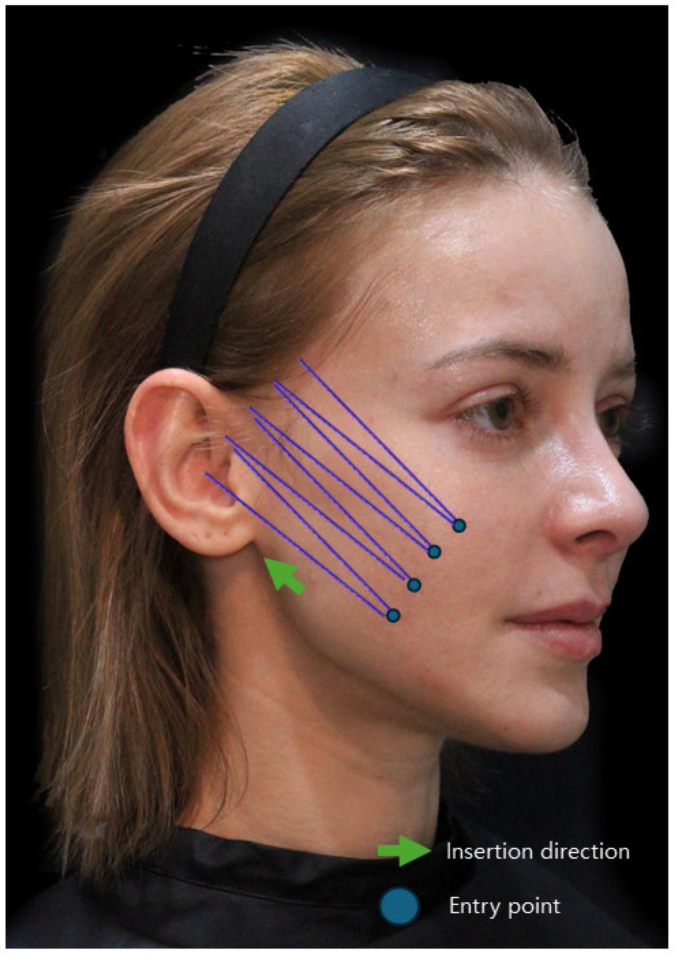 Diagnostics 14 00716 g014