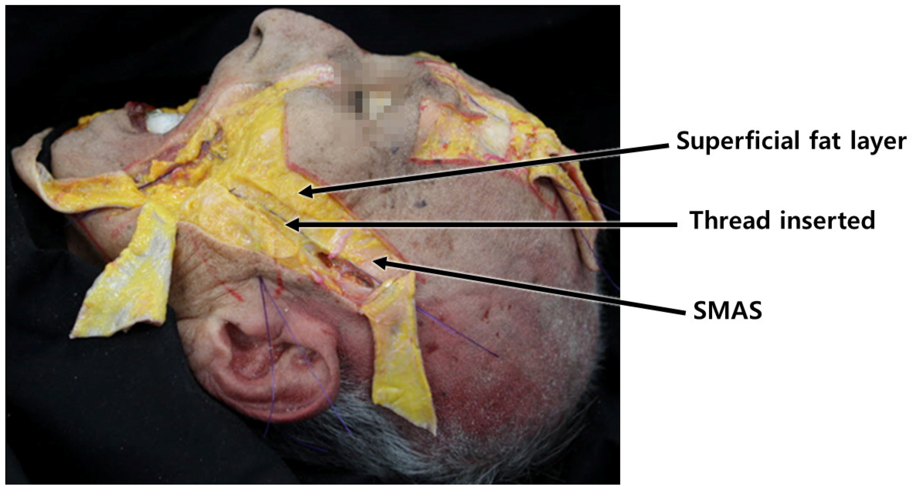 Diagnostics 14 00716 g017