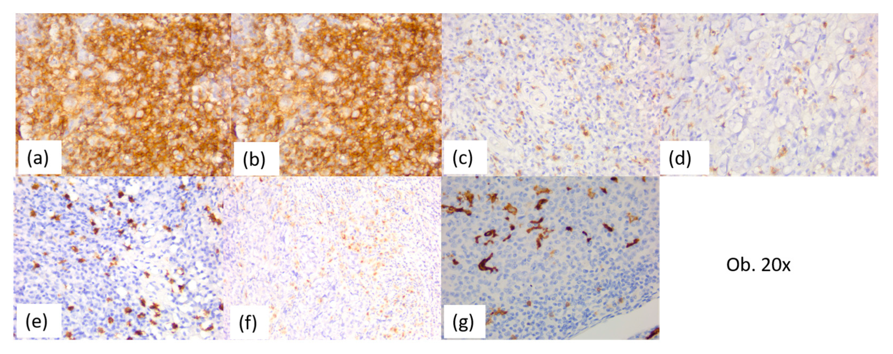 Diagnostics 14 00722 g011