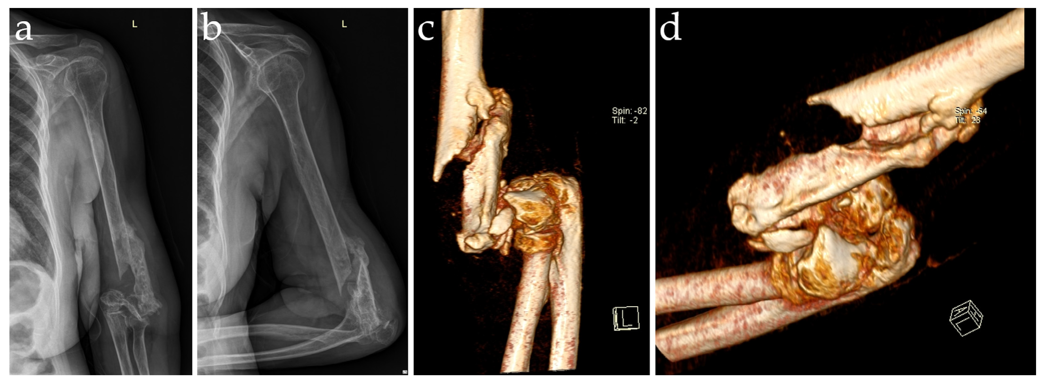 Diagnostics 14 00724 g001