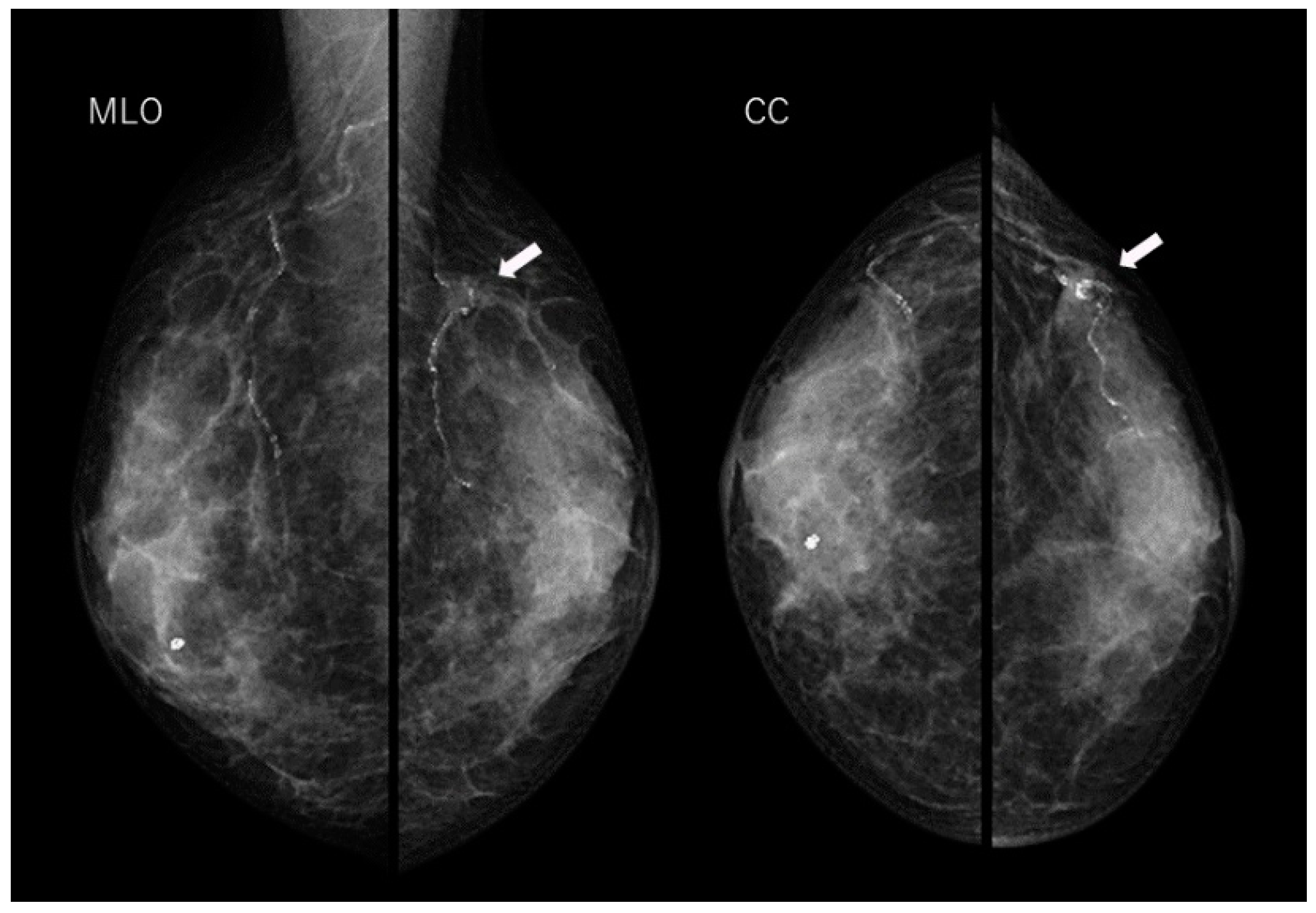 Diagnostics 14 00727 g001