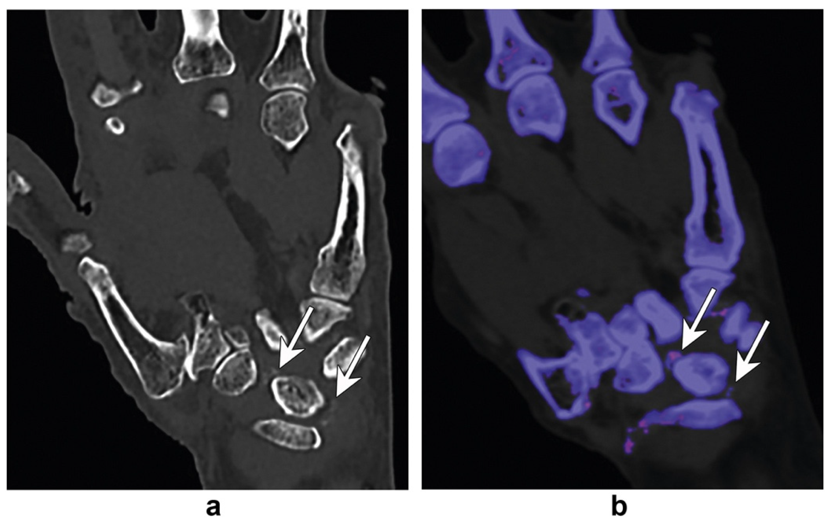 Diagnostics 14 00732 g003