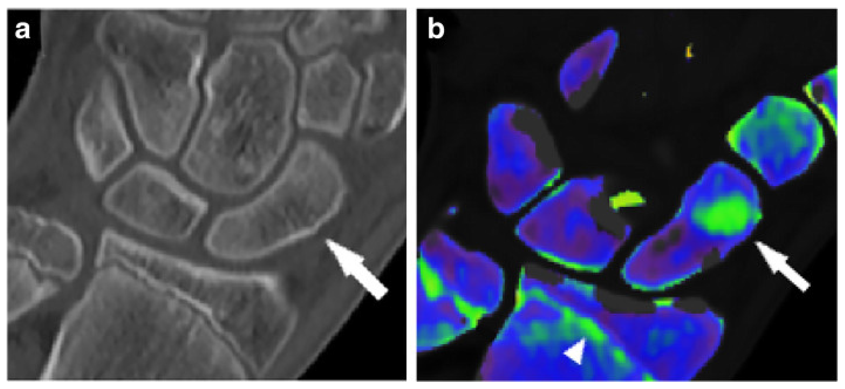 Diagnostics 14 00732 g005