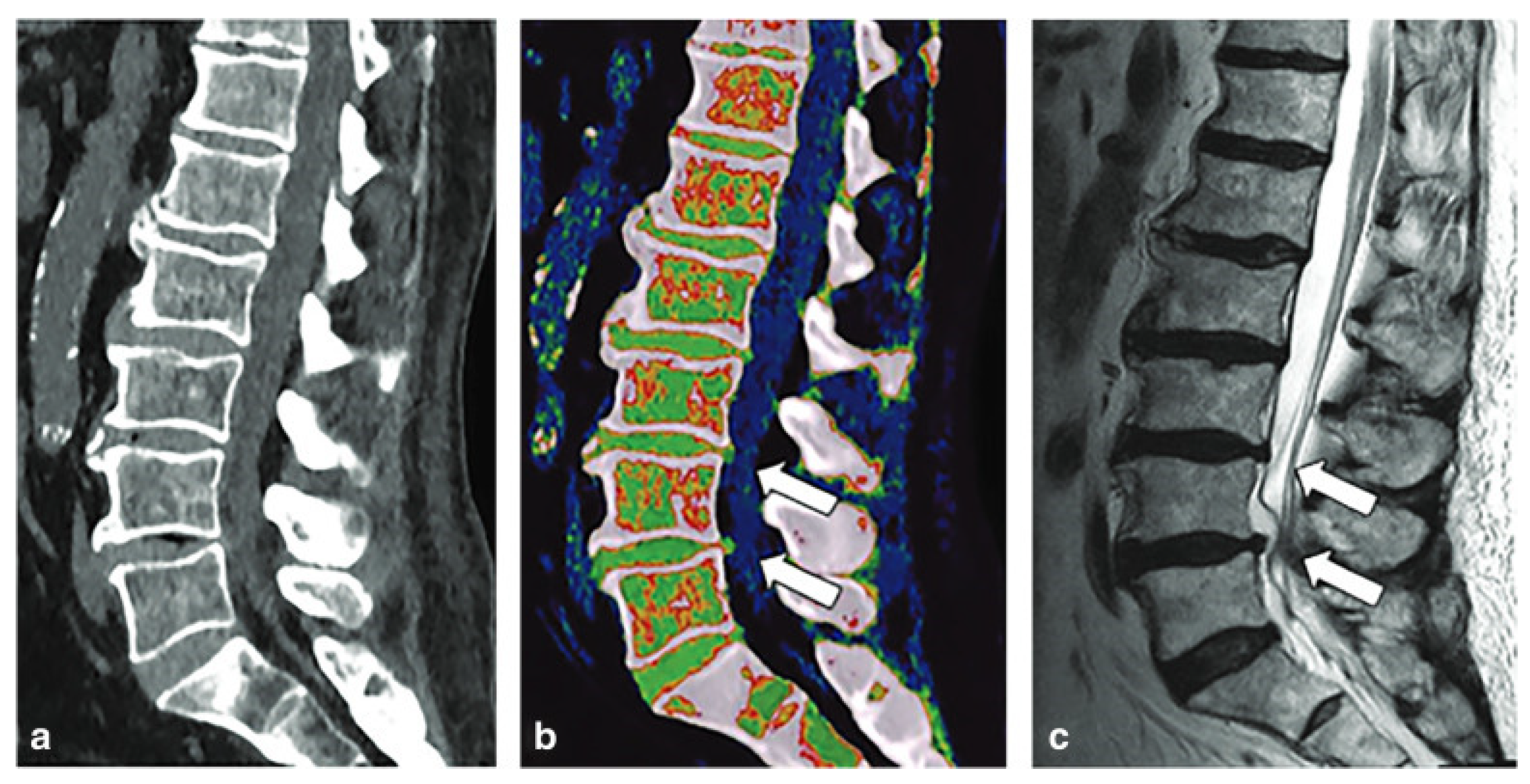 Diagnostics 14 00732 g007