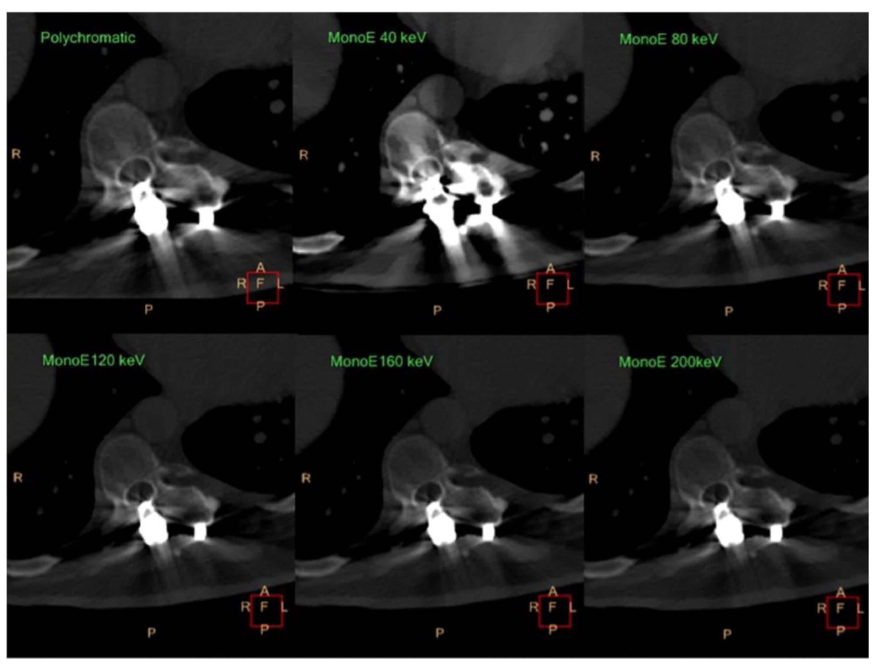 Diagnostics 14 00732 g009