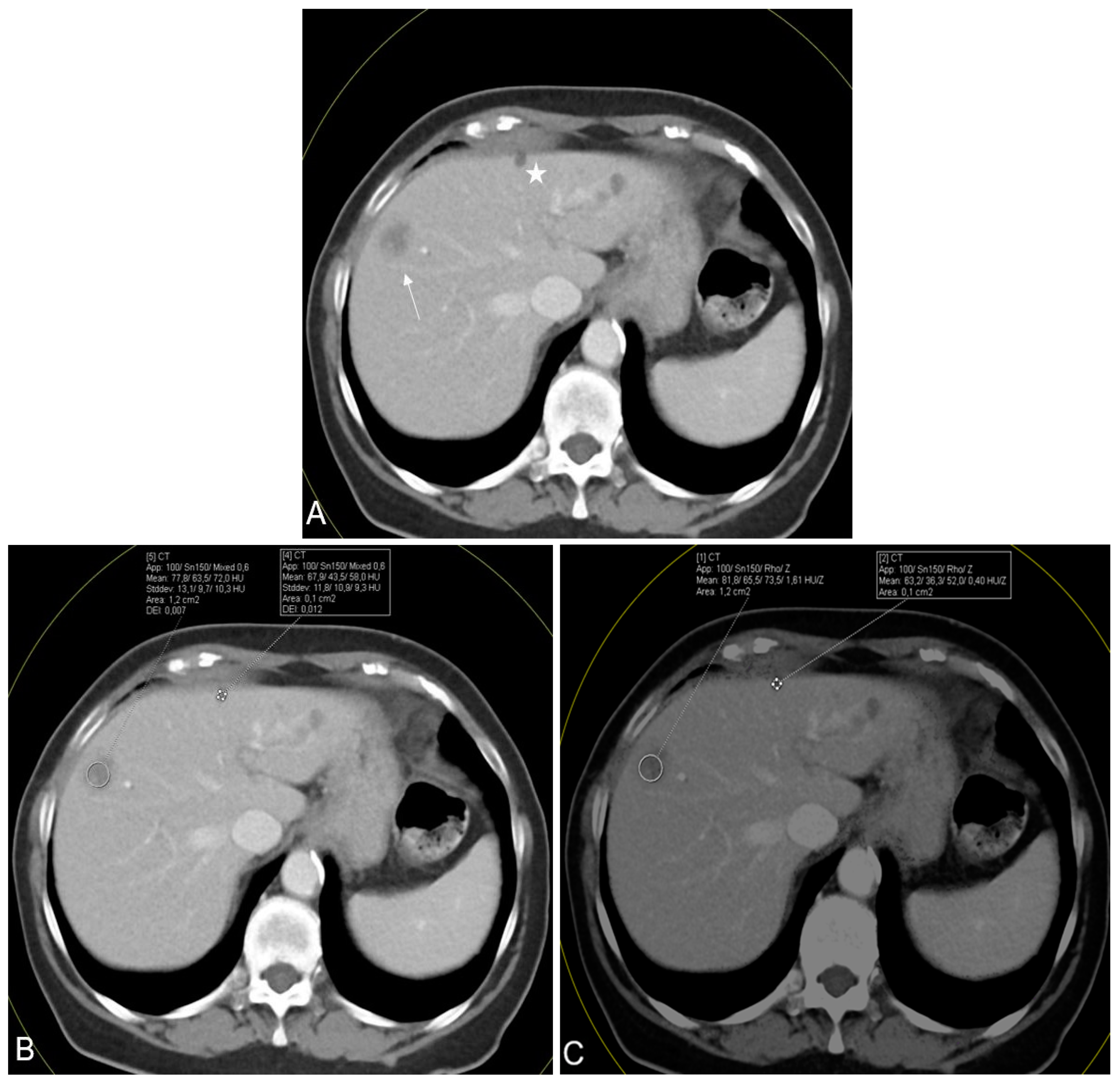Diagnostics 14 00742 g005