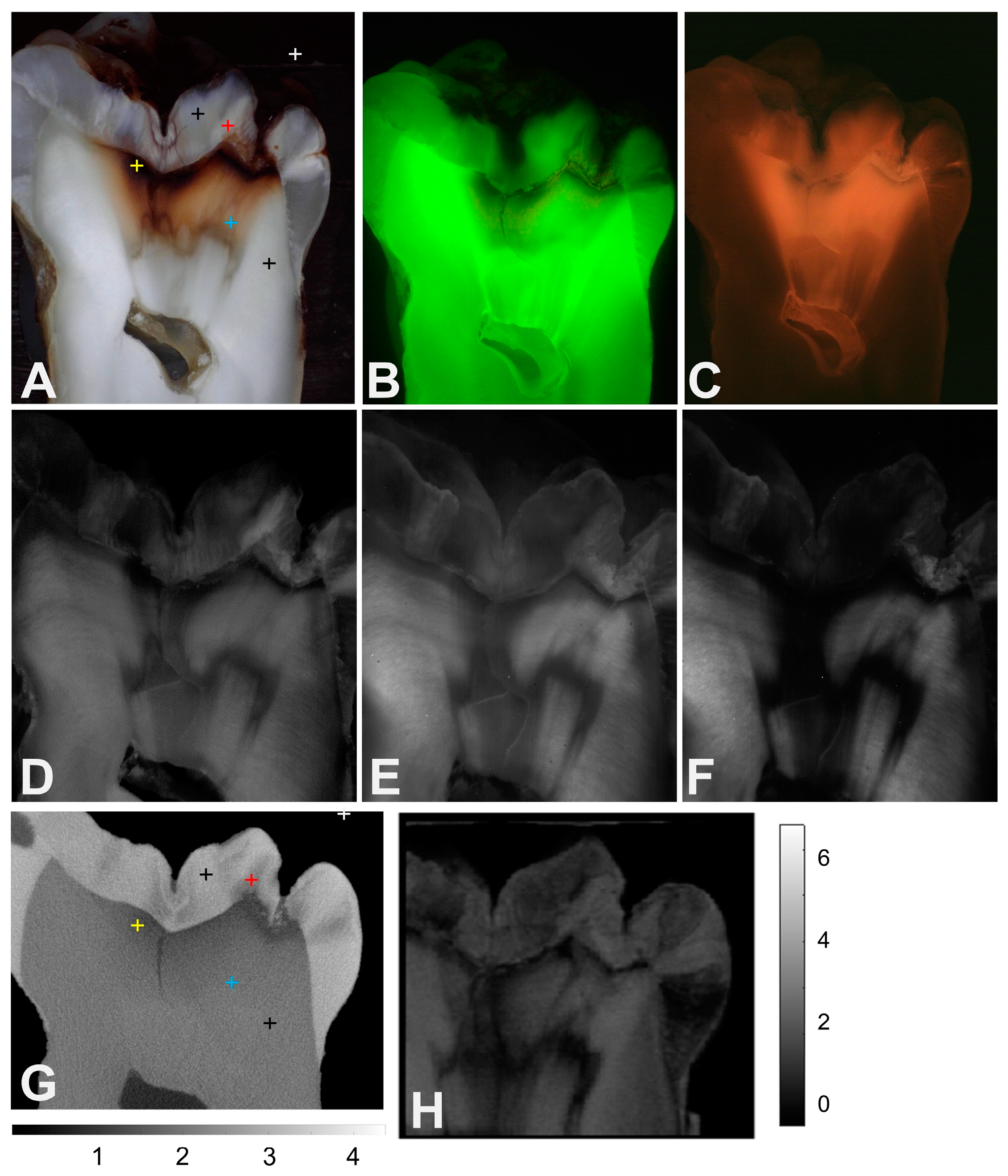 Diagnostics 14 00744 g003