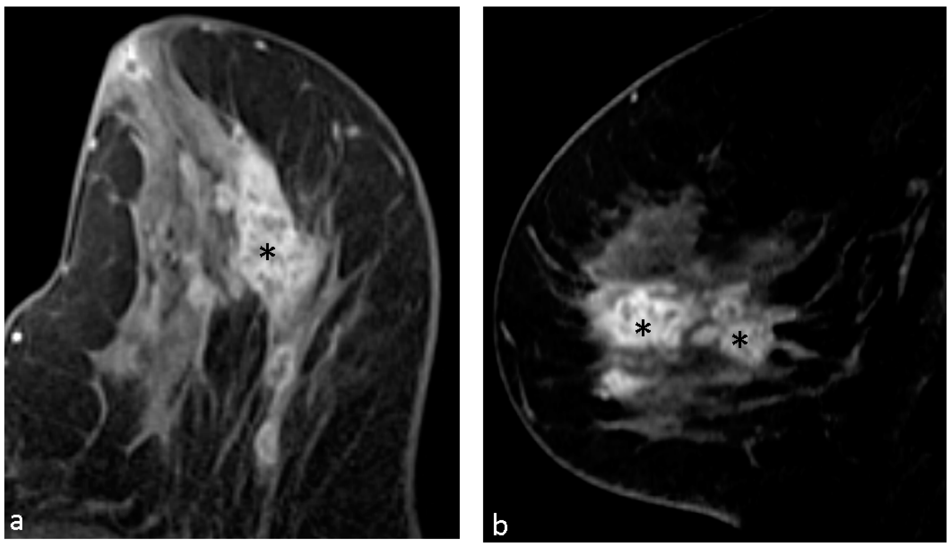 Diagnostics 14 00747 g003