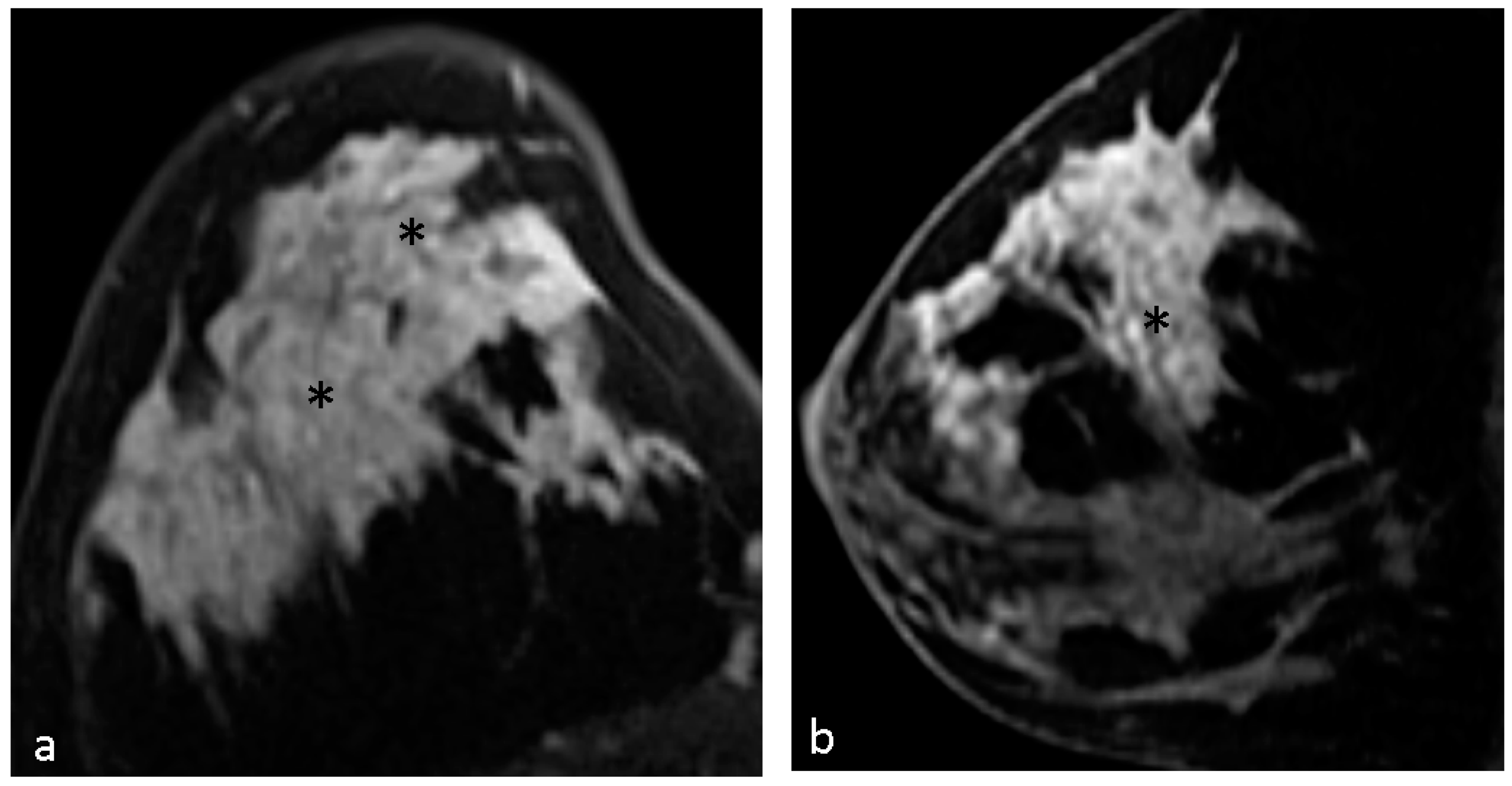 Diagnostics 14 00747 g004
