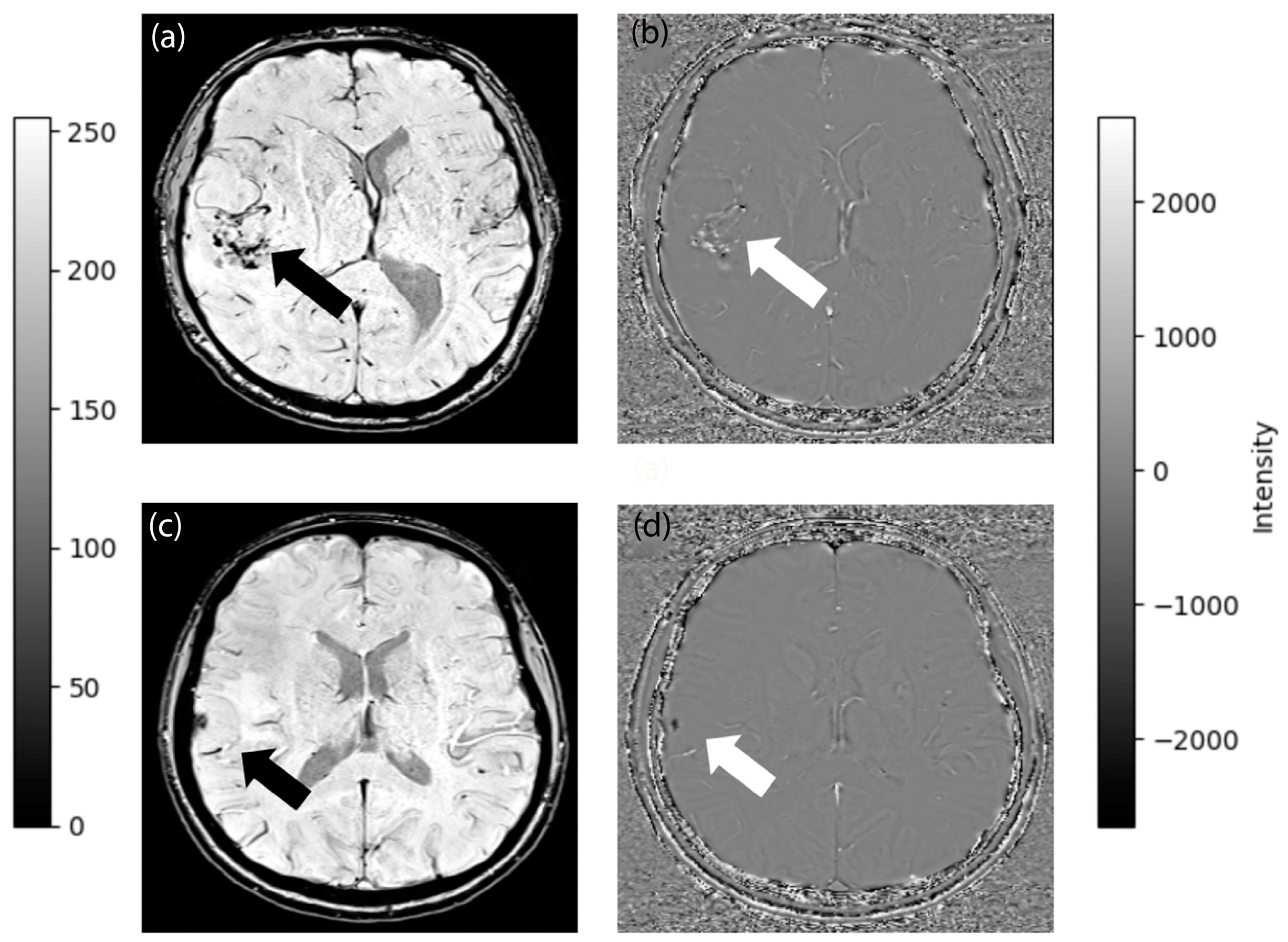 Diagnostics 14 00748 g002