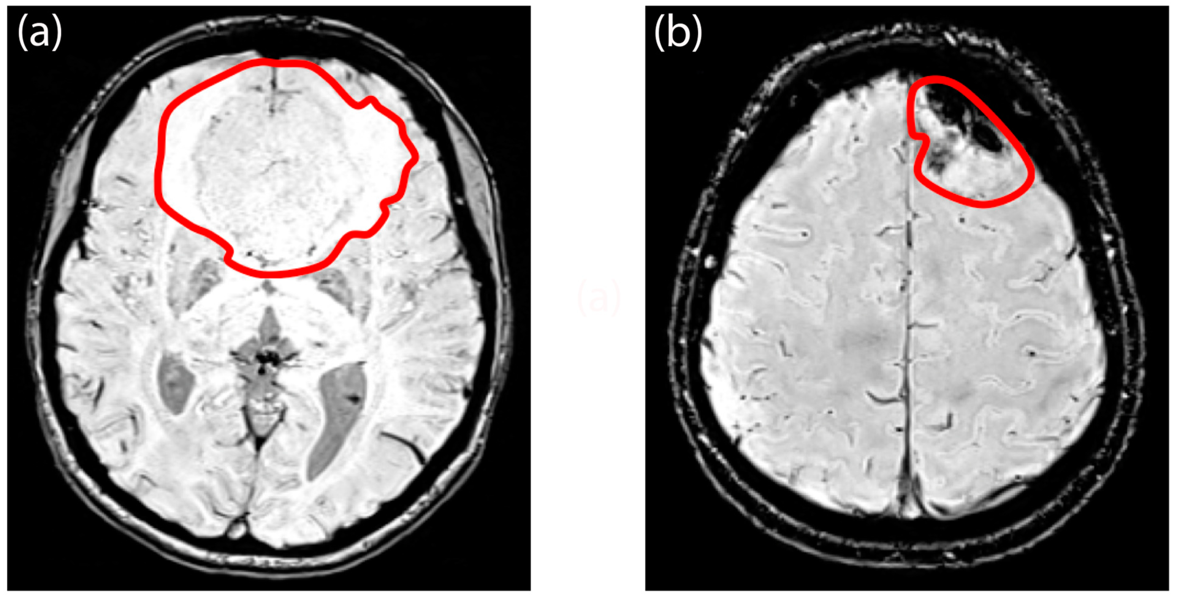 Diagnostics 14 00748 g007