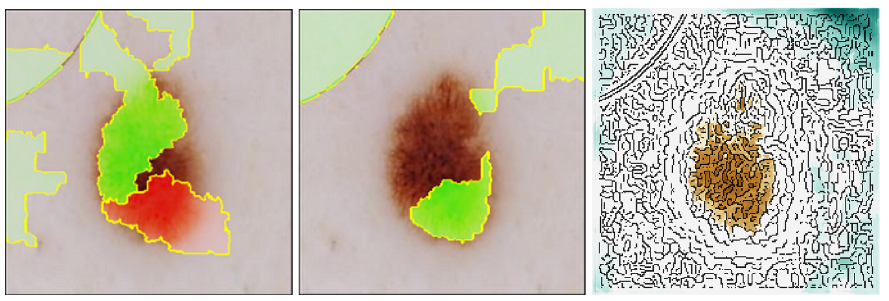 Diagnostics 14 00753 g015