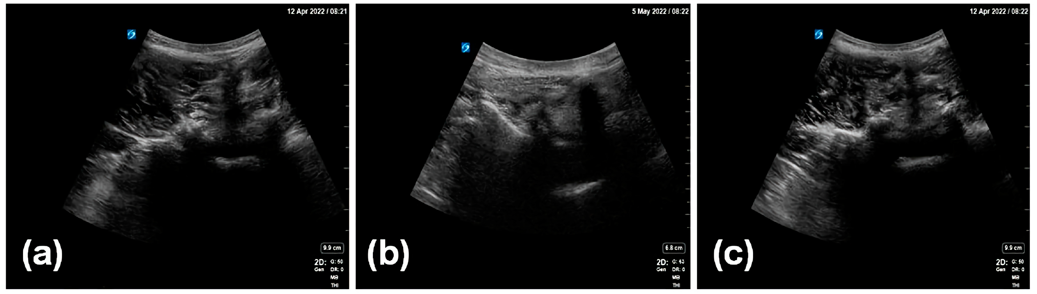 Diagnostics 14 00755 g002