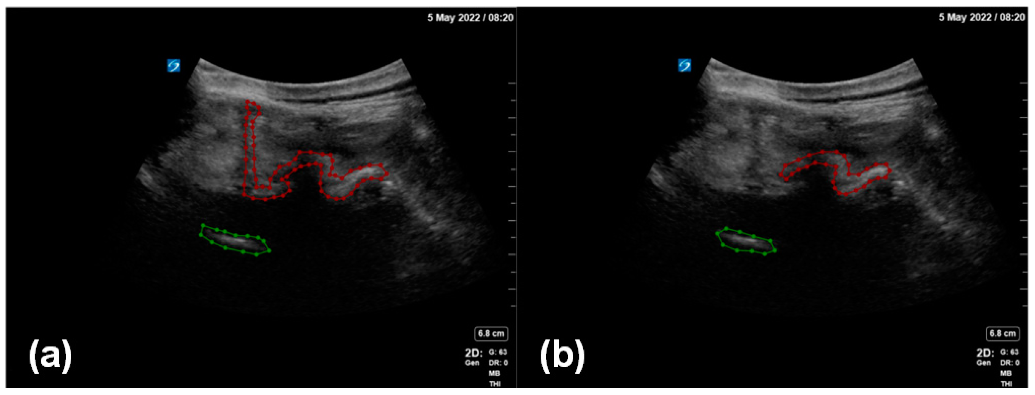 Diagnostics 14 00755 g003