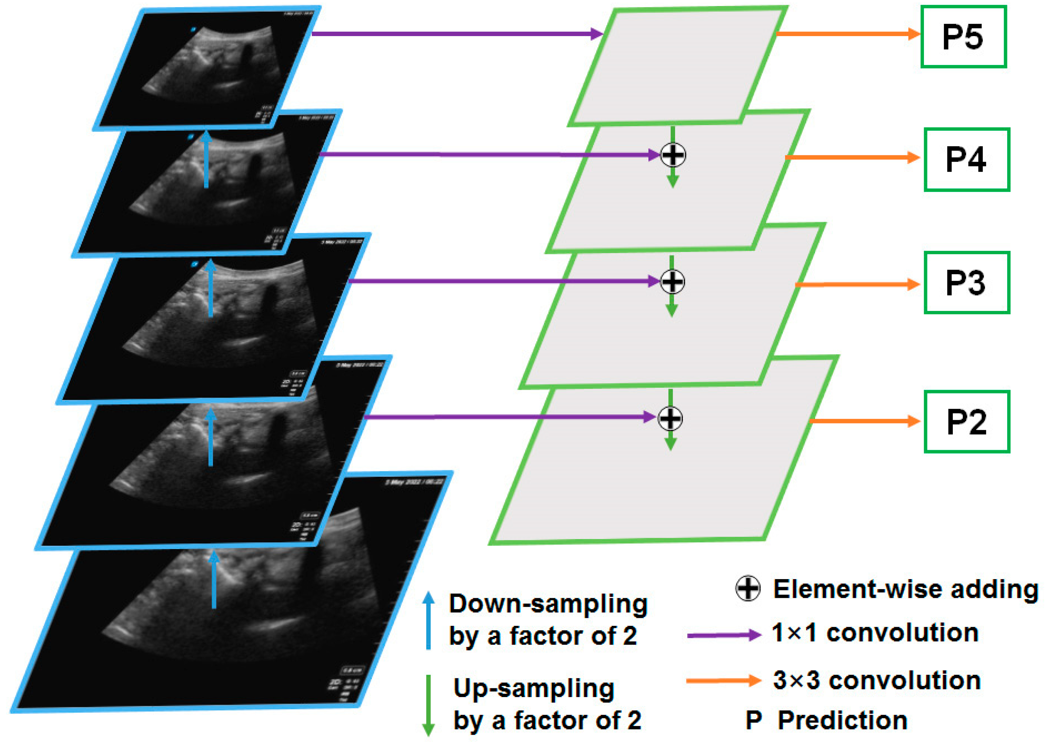Diagnostics 14 00755 g004