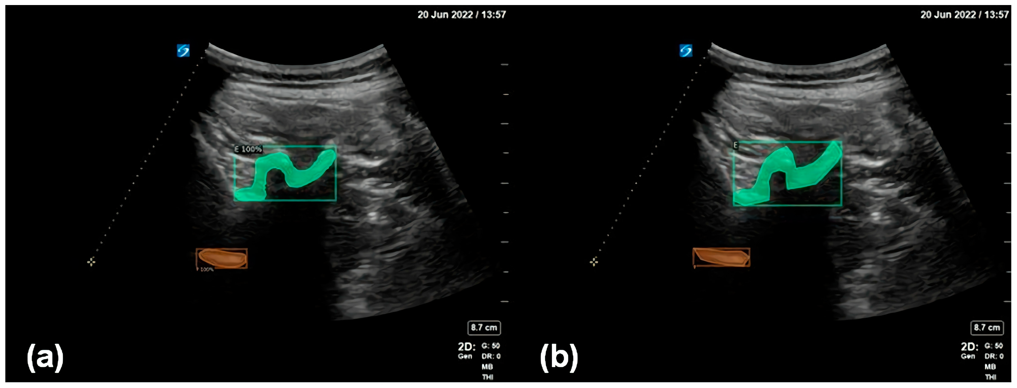 Diagnostics 14 00755 g005