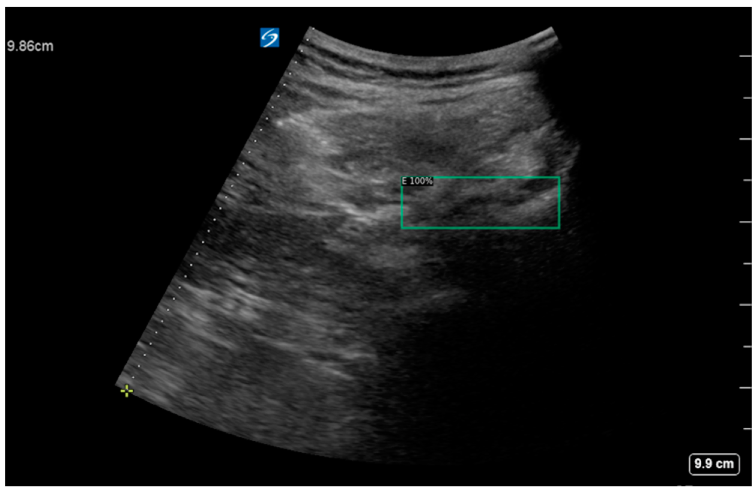 Diagnostics 14 00755 g006