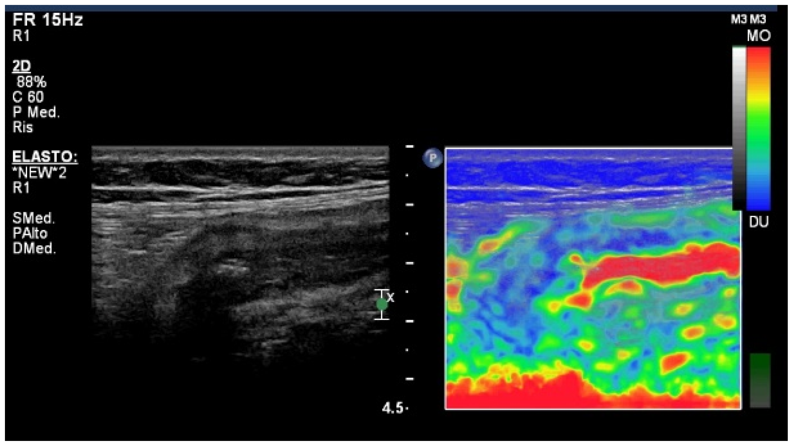 Diagnostics 14 00759 g002