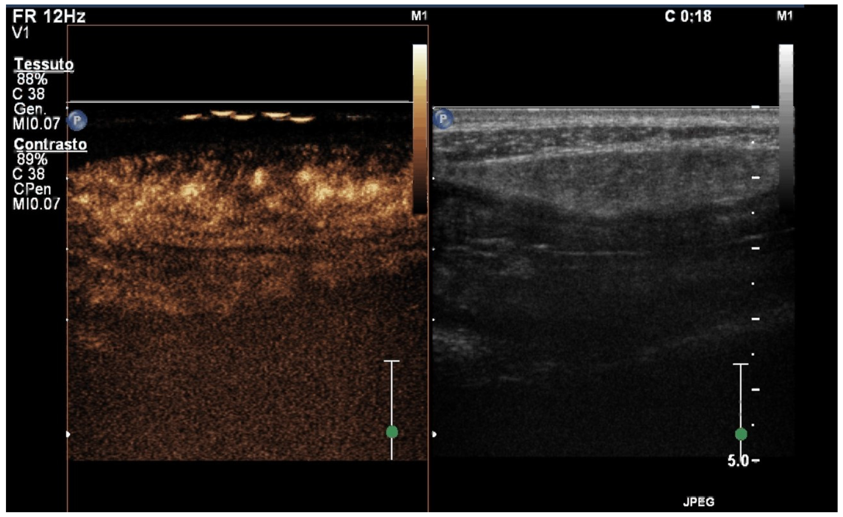 Diagnostics 14 00759 g004