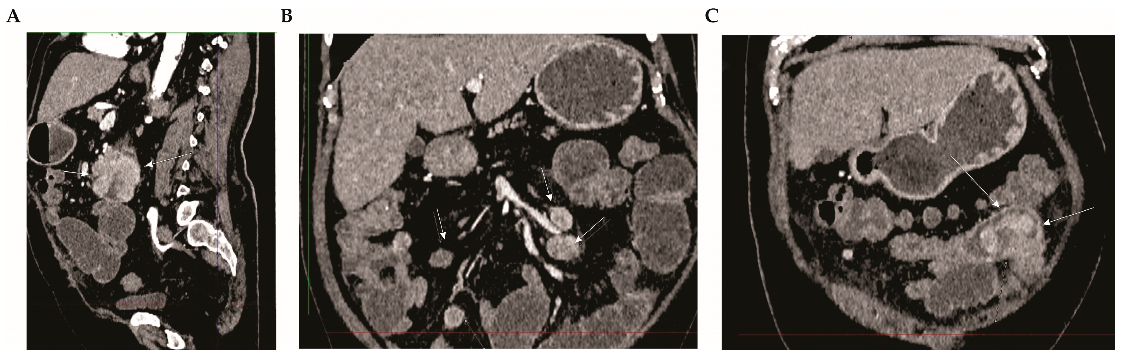 Diagnostics 14 00761 g001 Diagnostics 14 00761 g001