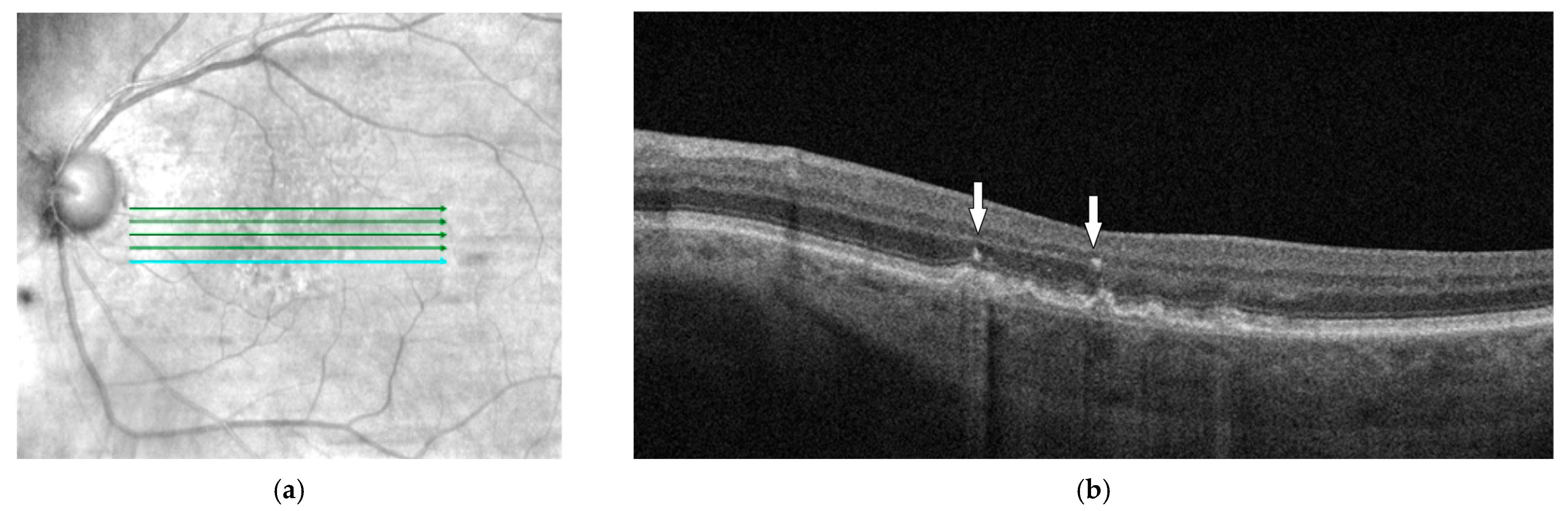Diagnostics 14 00764 g001