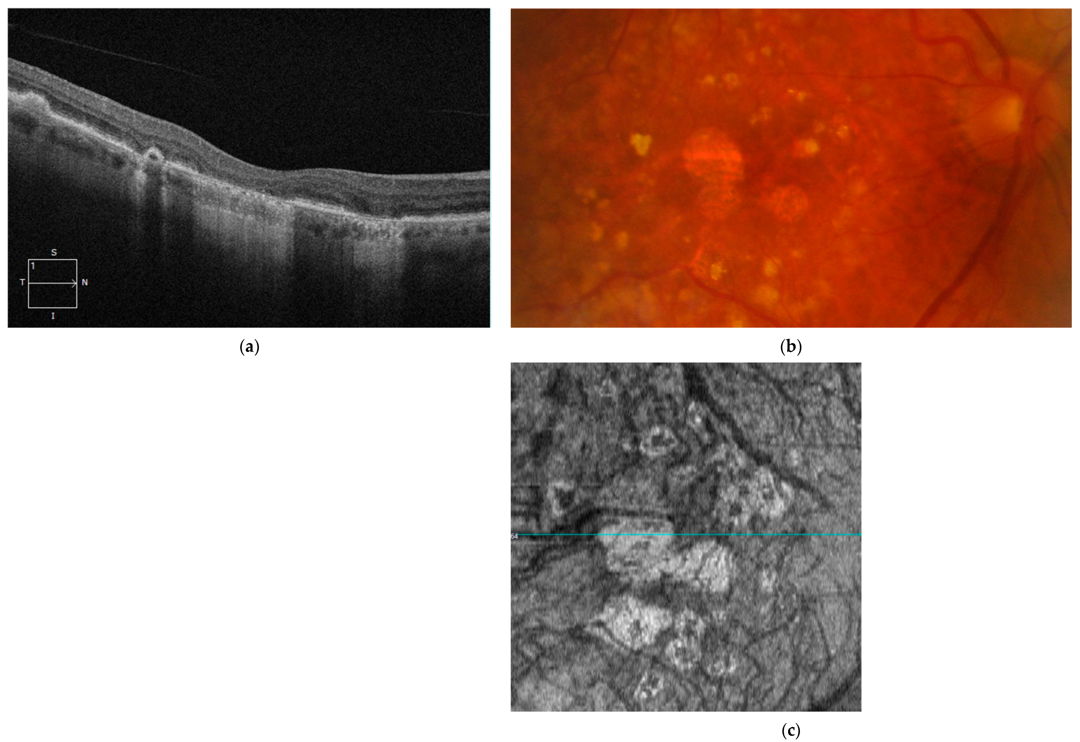 Diagnostics 14 00764 g003