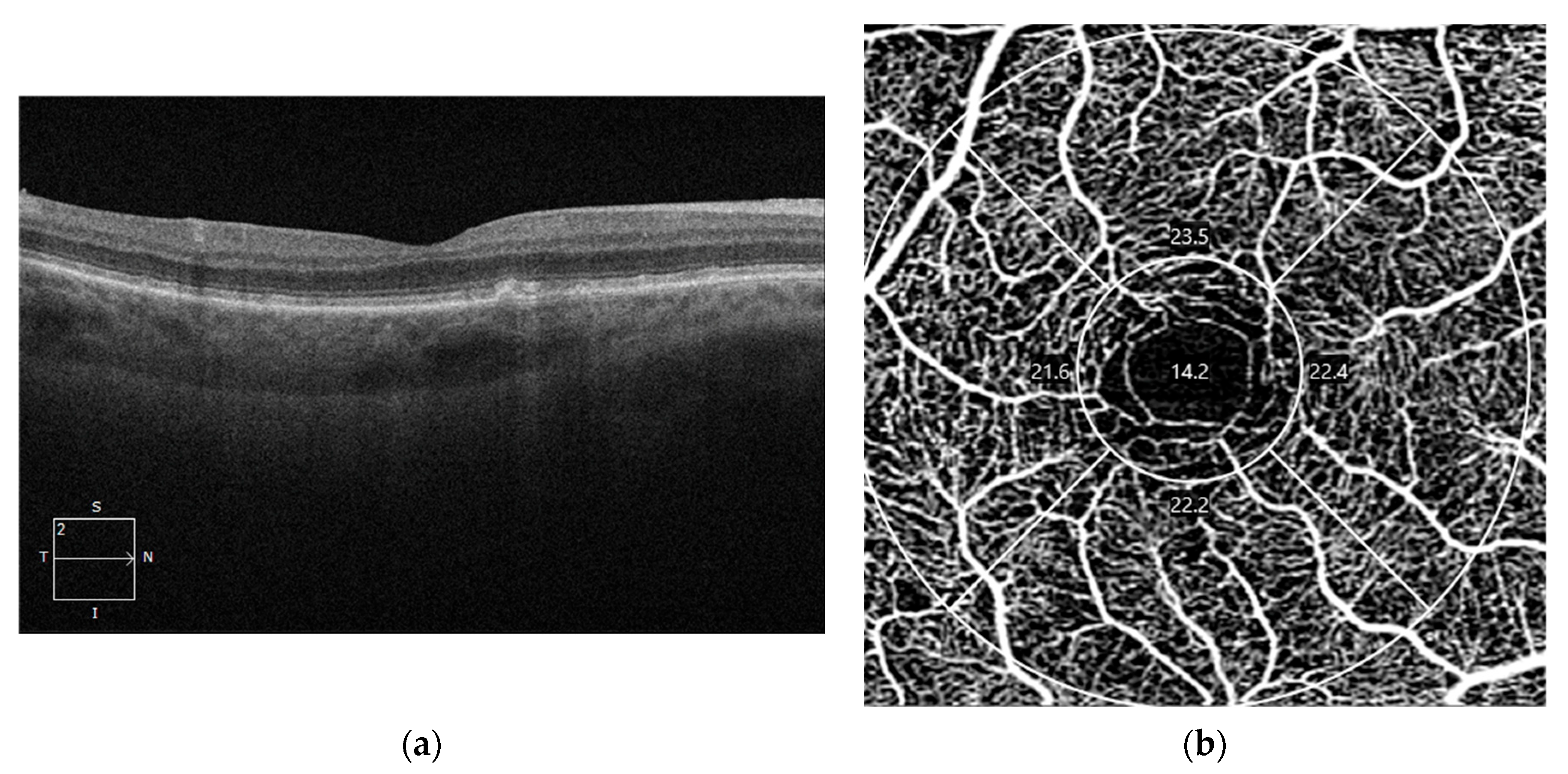 Diagnostics 14 00764 g004a