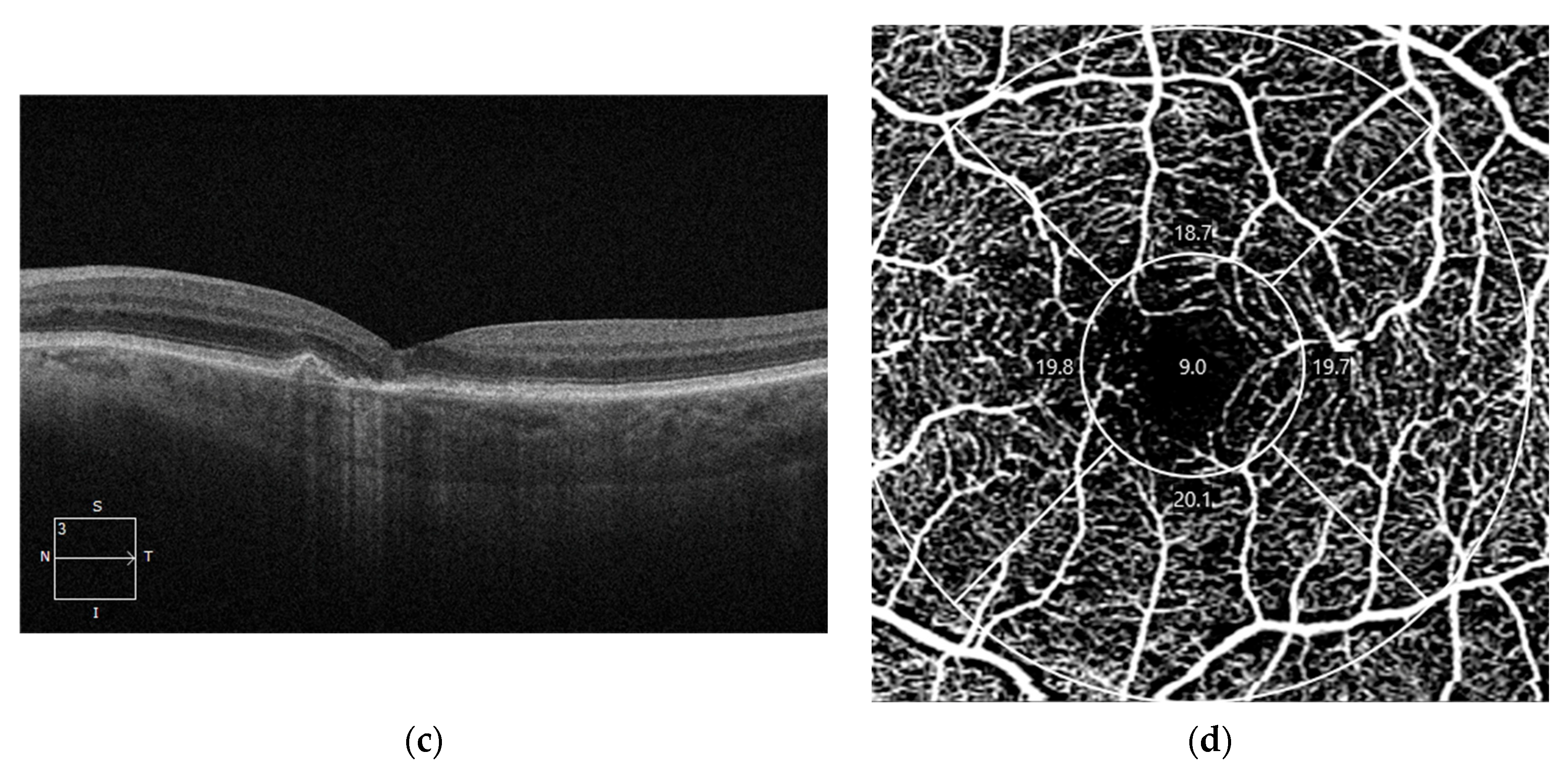 Diagnostics 14 00764 g004b