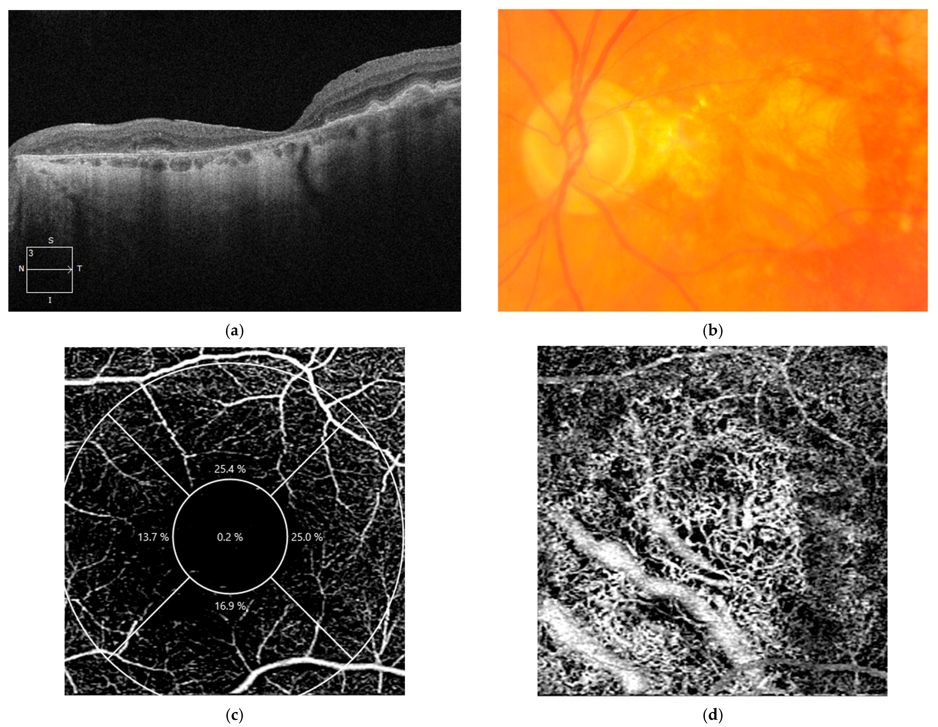 Diagnostics 14 00764 g005