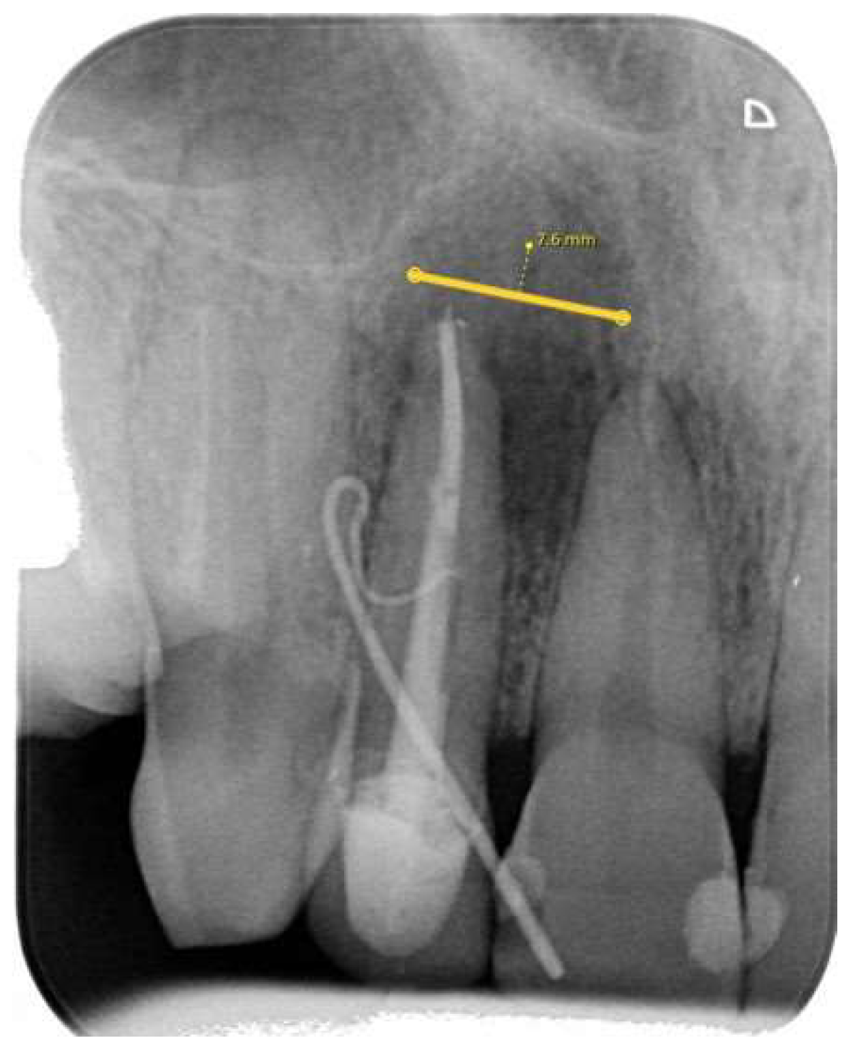 Diagnostics 14 00766 g001