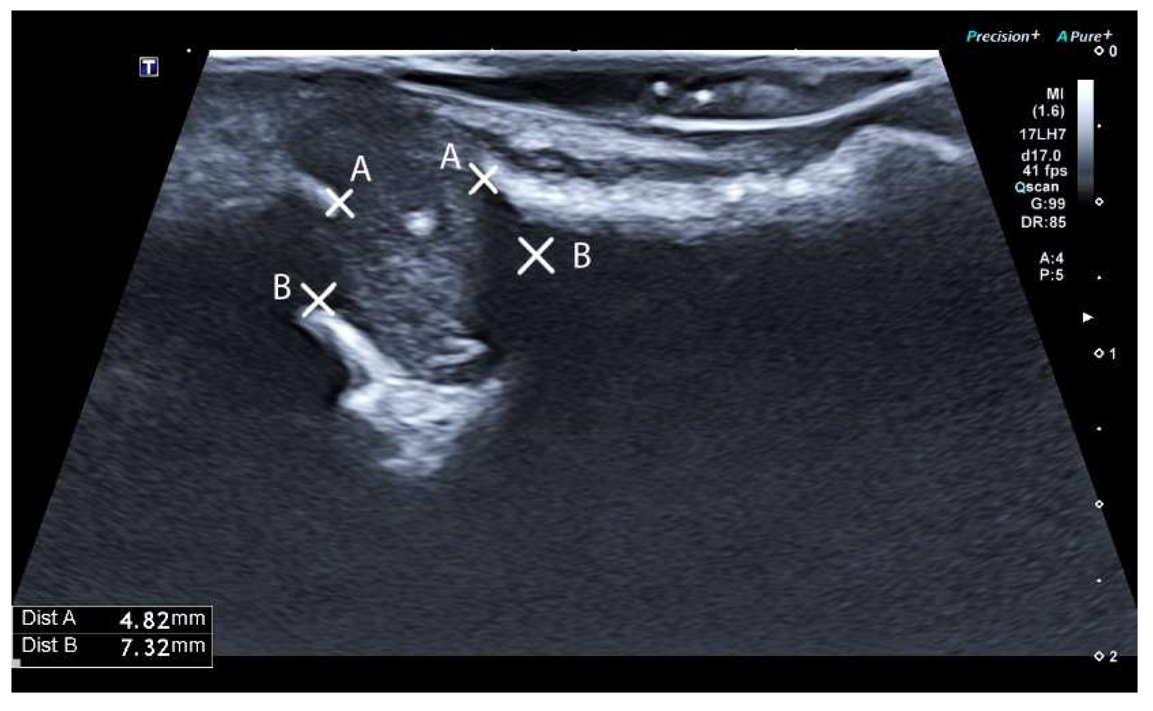 Diagnostics 14 00766 g005