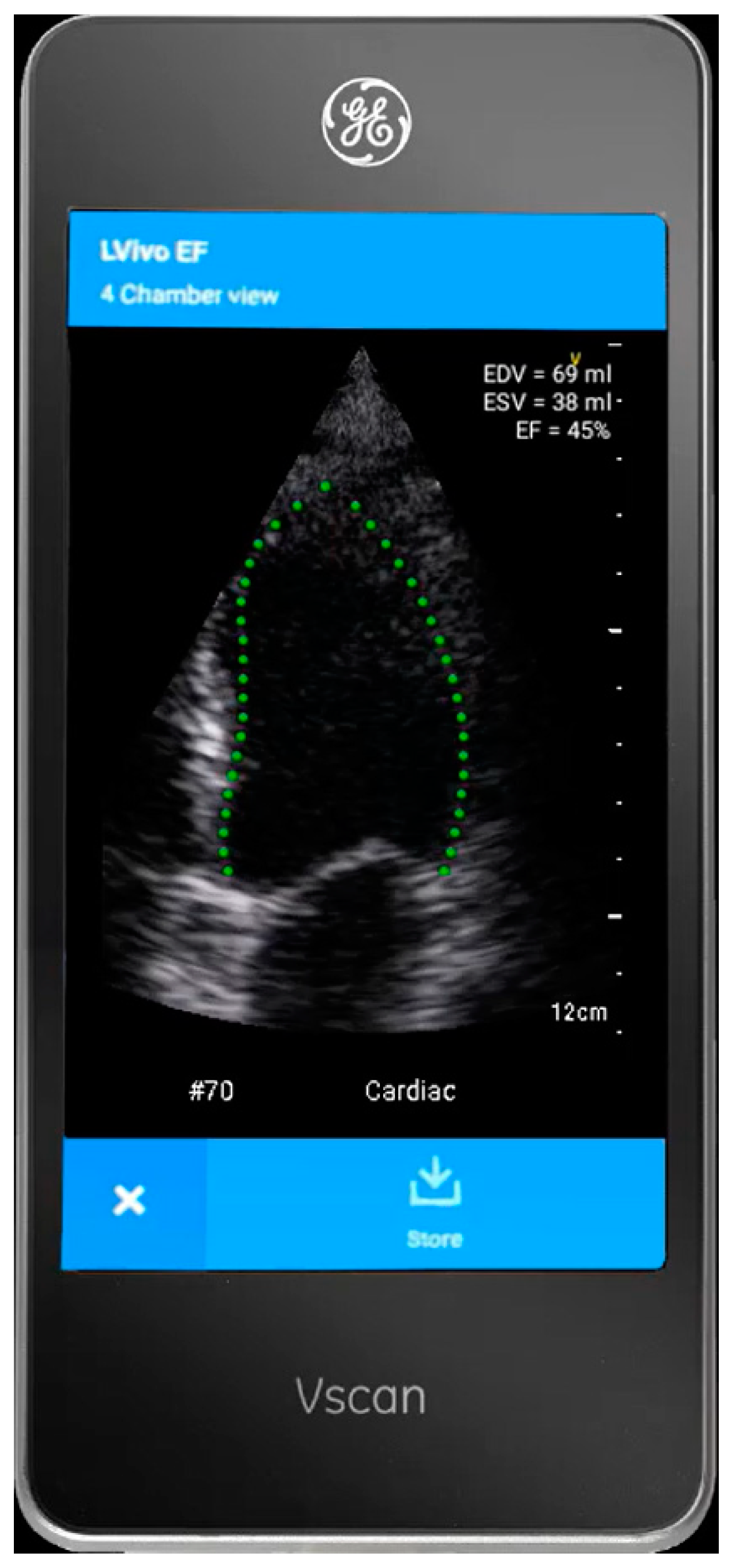 Diagnostics 14 00767 g001